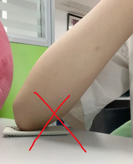 肘横纹就是胳膊弯曲时肘关节前面那条明显的横线