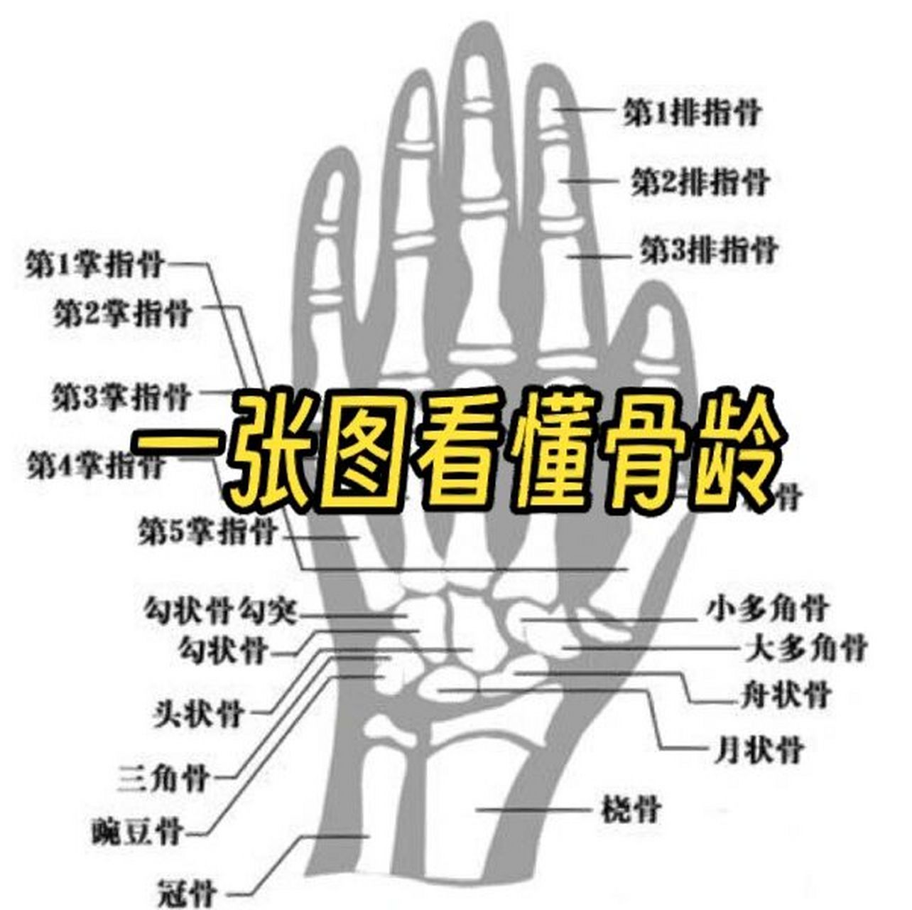 一张图教会你看骨龄片 方法:根据手掌的指骨,腕骨以及桡骨,尺骨下端的