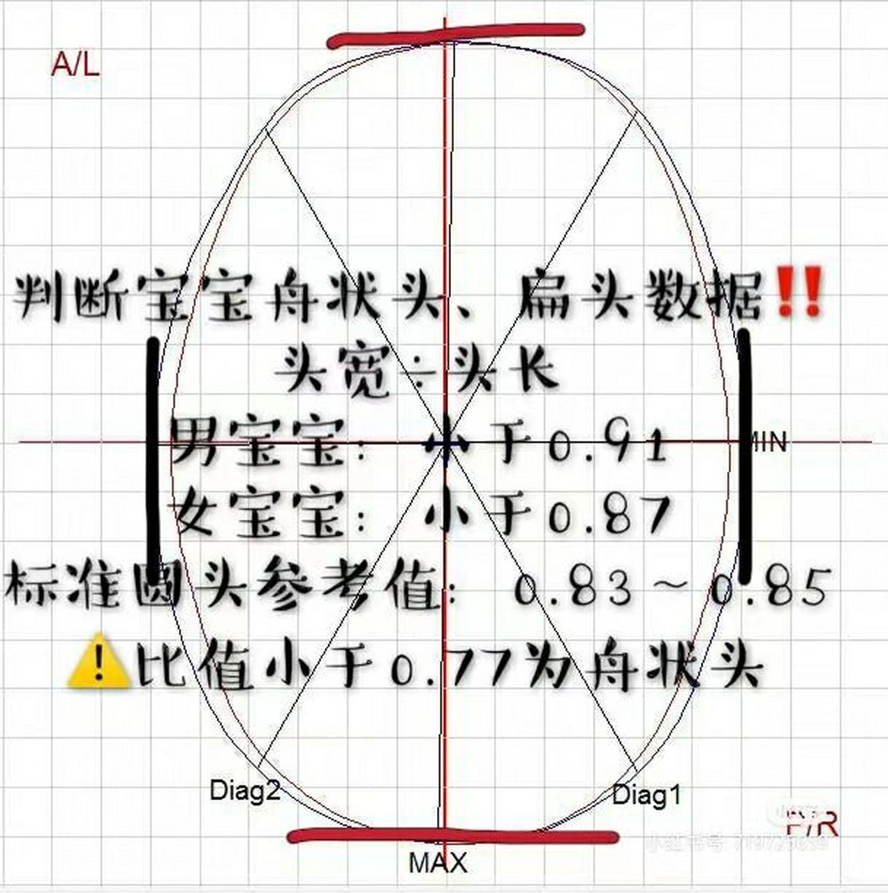 舟状头,扁头,斜头自测 您家宝宝的头型是正常吗?