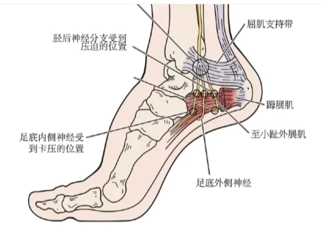 足部结构