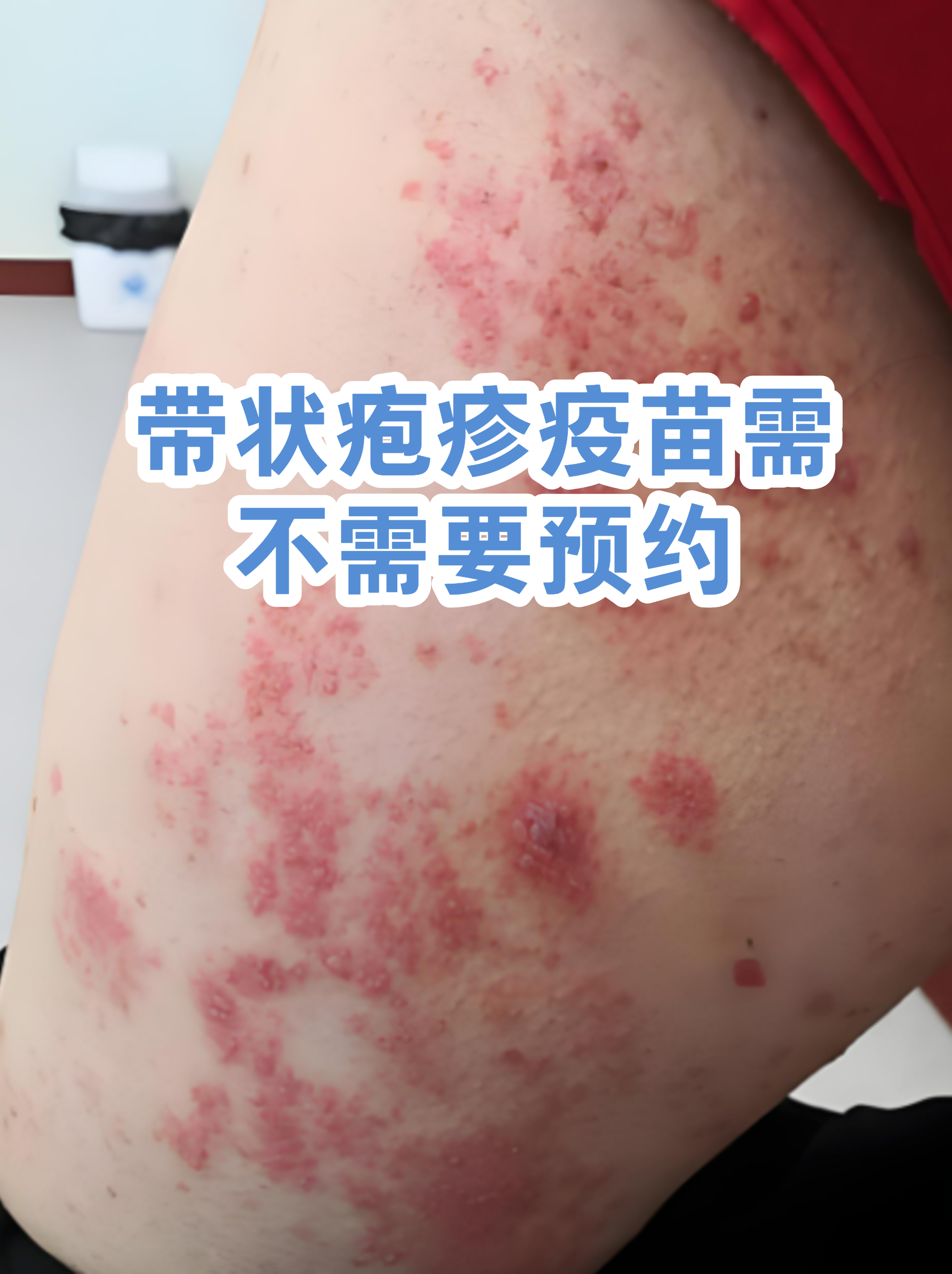 关于北京大学口腔医院预约检查陪诊挂号疫苗接种按时协助，全程不耽误的信息