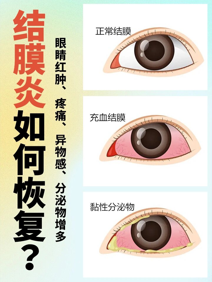 不过别担心,我们来聊聊为什么会得结膜炎以及如何治疗它吧! .