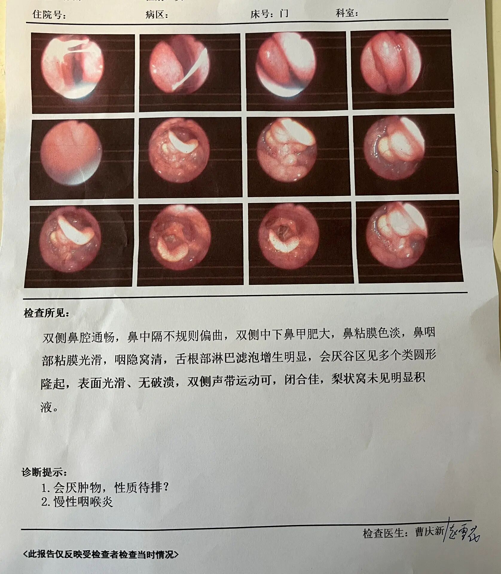 会厌囊肿手术多少钱图片