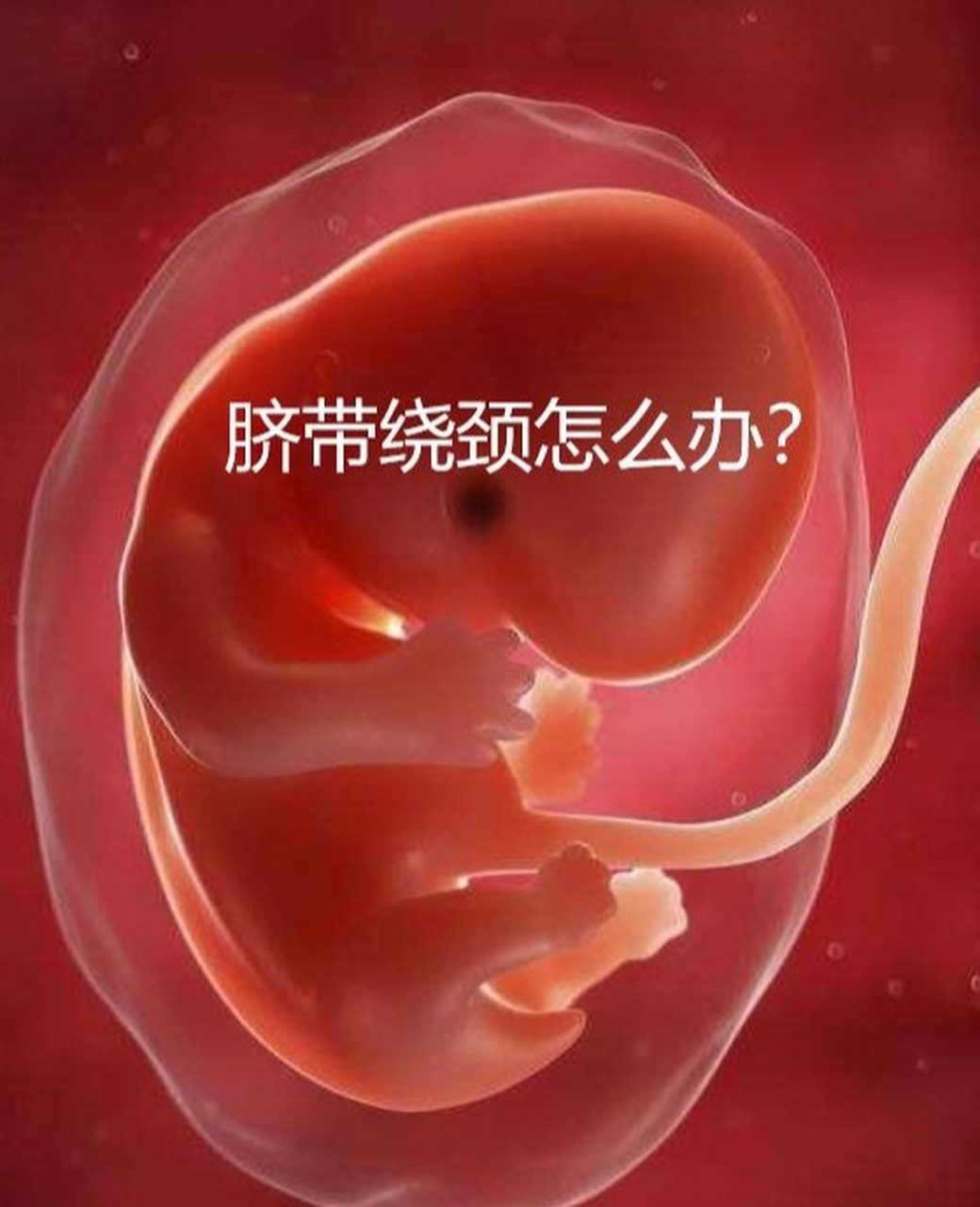 脐带绕颈怎么办?胎儿有危险吗?