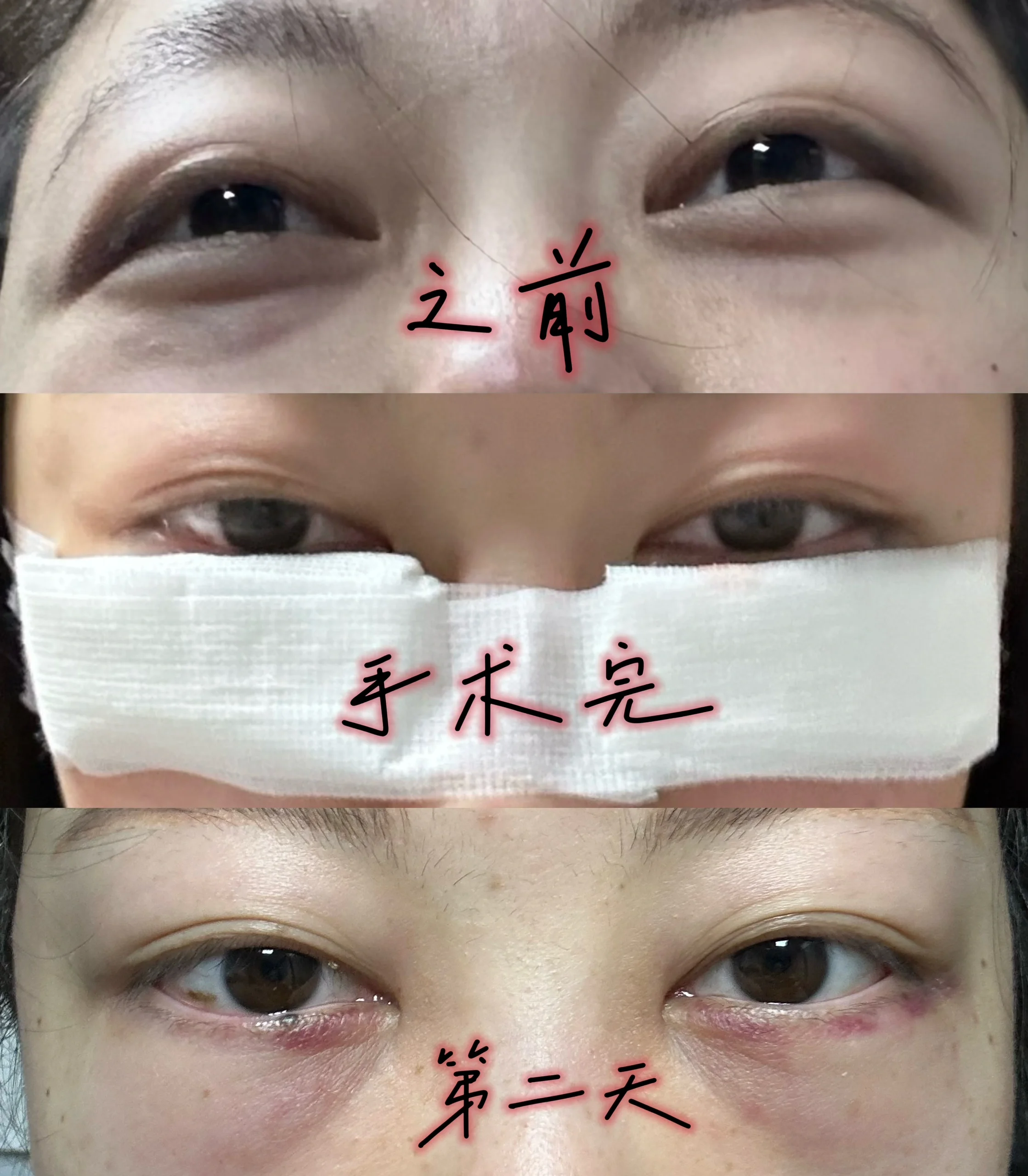 《重生之内切眼袋》 我重生了,这一次一定要夺回属于我的一切!