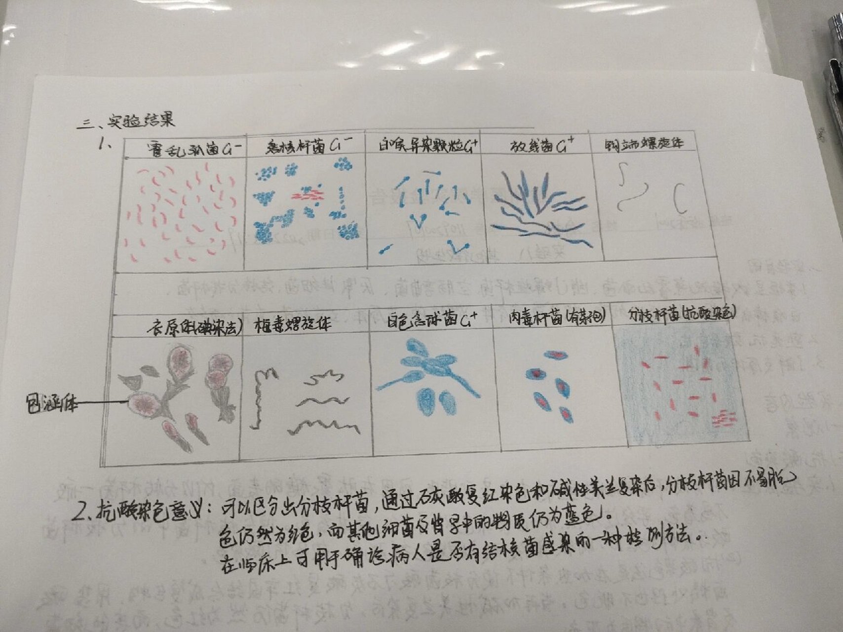 微生物绘图 衣原体,白色念球菌,结核杆菌,分枝杆菌(抗酸染色),放线菌
