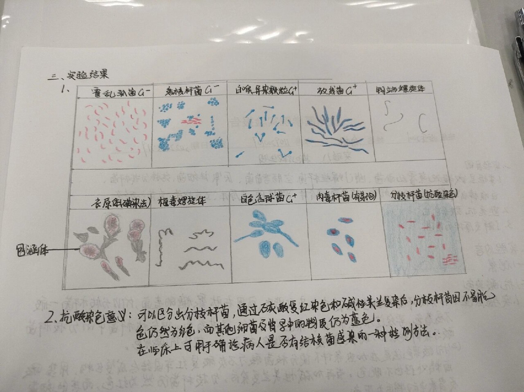 结核分枝杆菌手绘图片图片