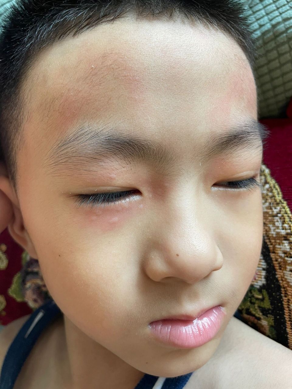 以前吃桃子没事,这两天突然对桃子过敏 想跟各位宝妈了解下,有没有