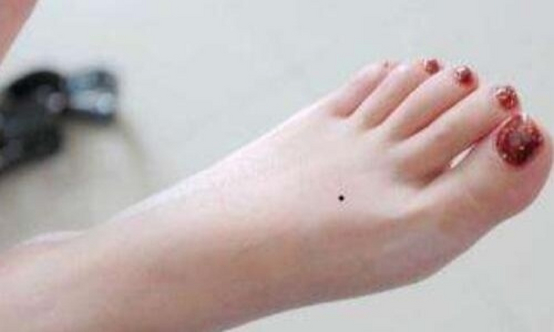 女生脚背长痣好不好 女生脚背长痣富贵 脚背上长痣,基本上都是奔波