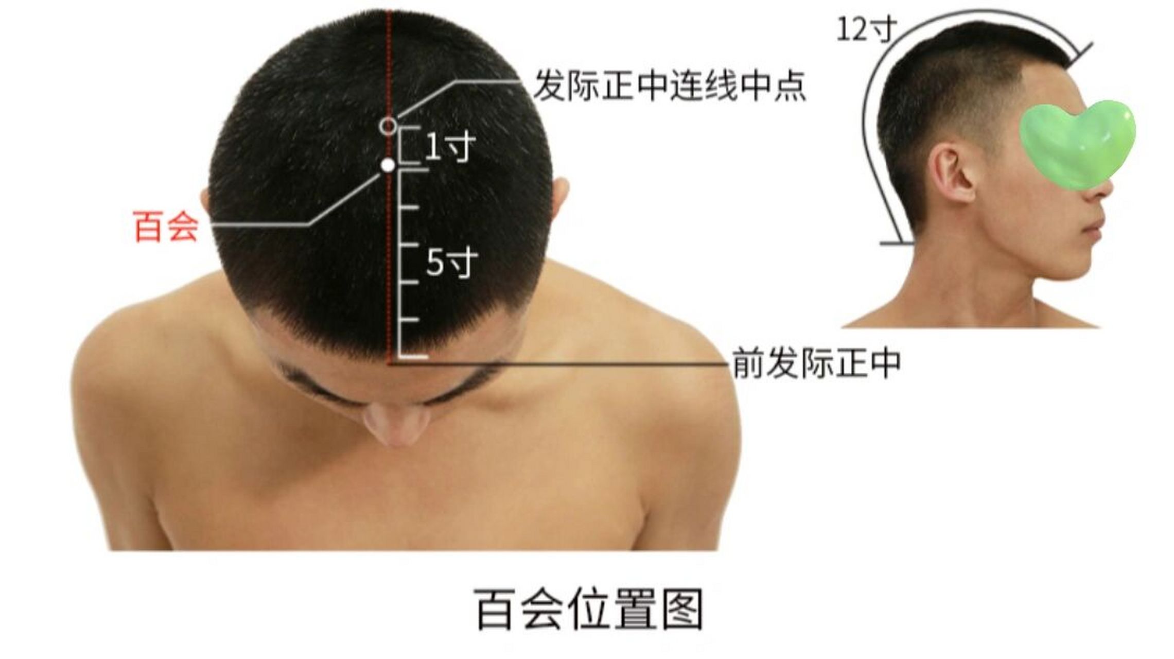 百会位置图片