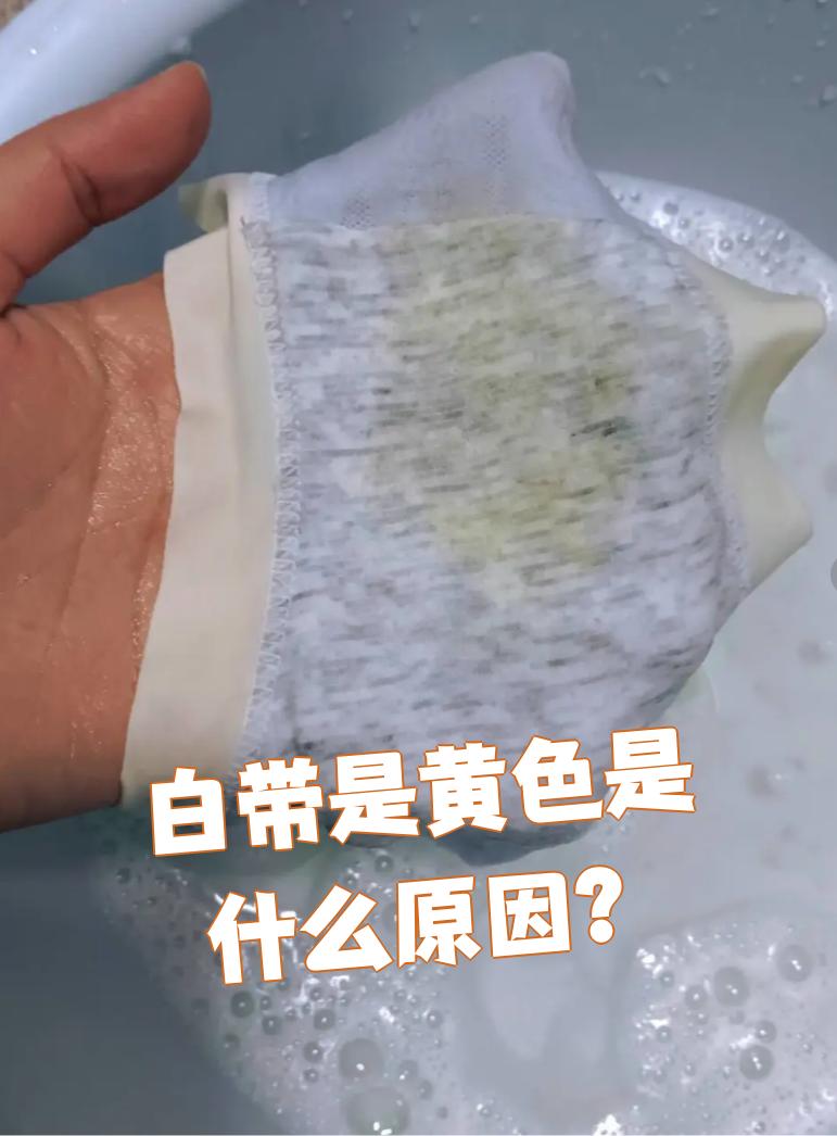 白带变黄最常见的原因是感染,少数情况下和卫生习惯不好有关