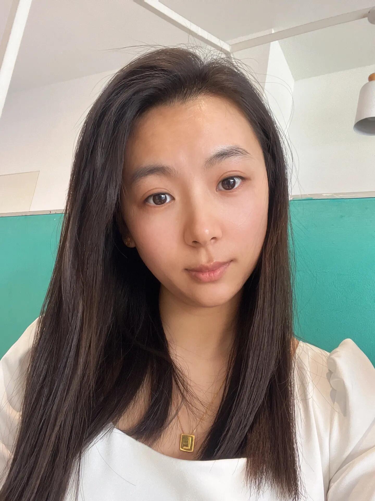 前两张是没有打肉毒素的素颜照片,笑起来弯弯的月牙眼,自我感觉真的