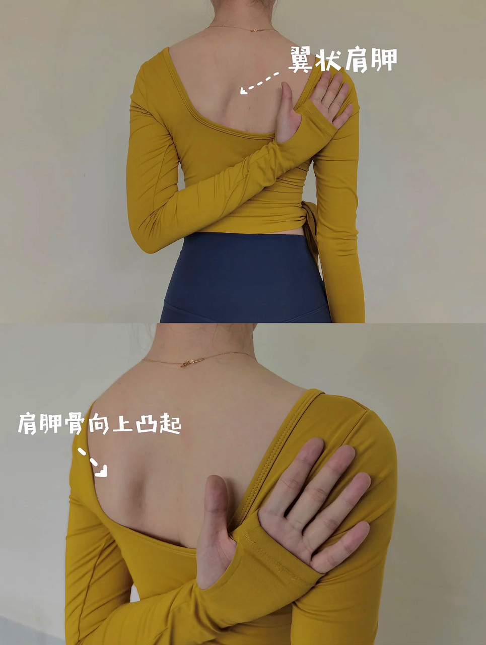 美背71翼状肩胛71你真的分清楚了吗6315 不少姐妹会在评论区