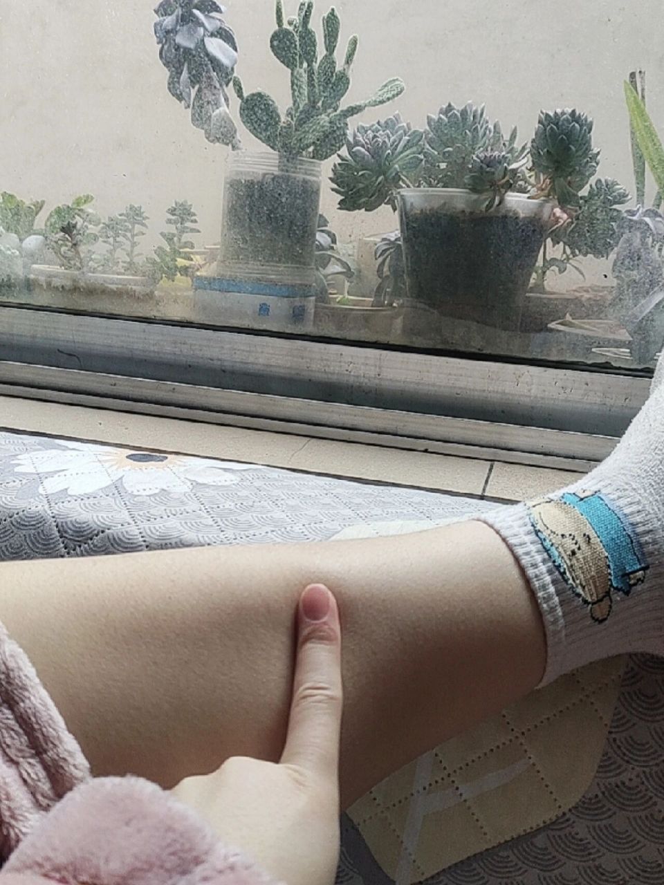 小腿内侧一按就疼什么原因