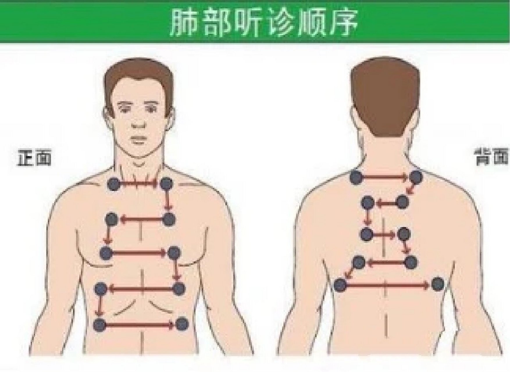 听诊器安装示意图图片