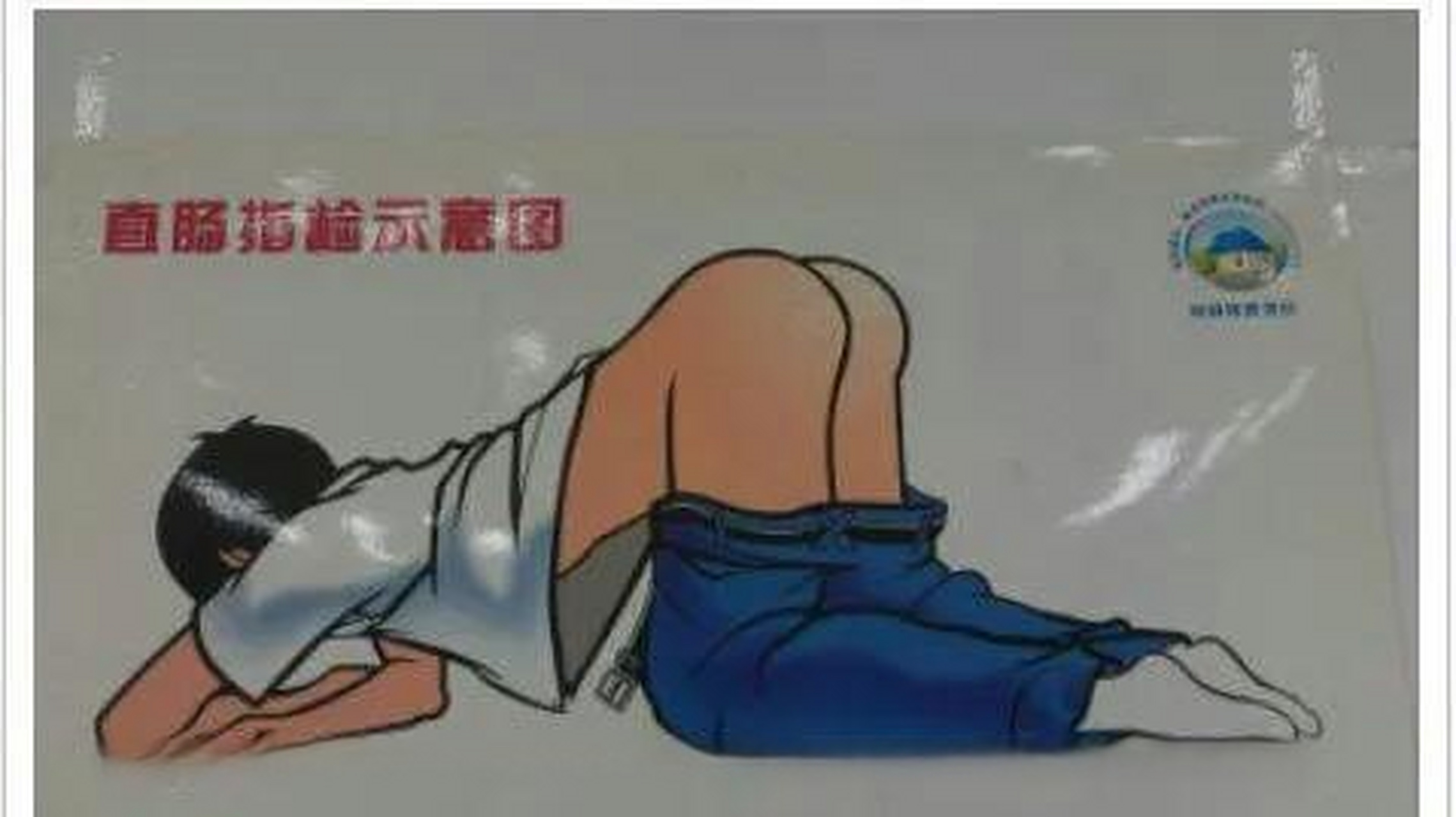 【检查前列腺时患者该如何配合】 膝胸卧位是医学临床实践中常见的一