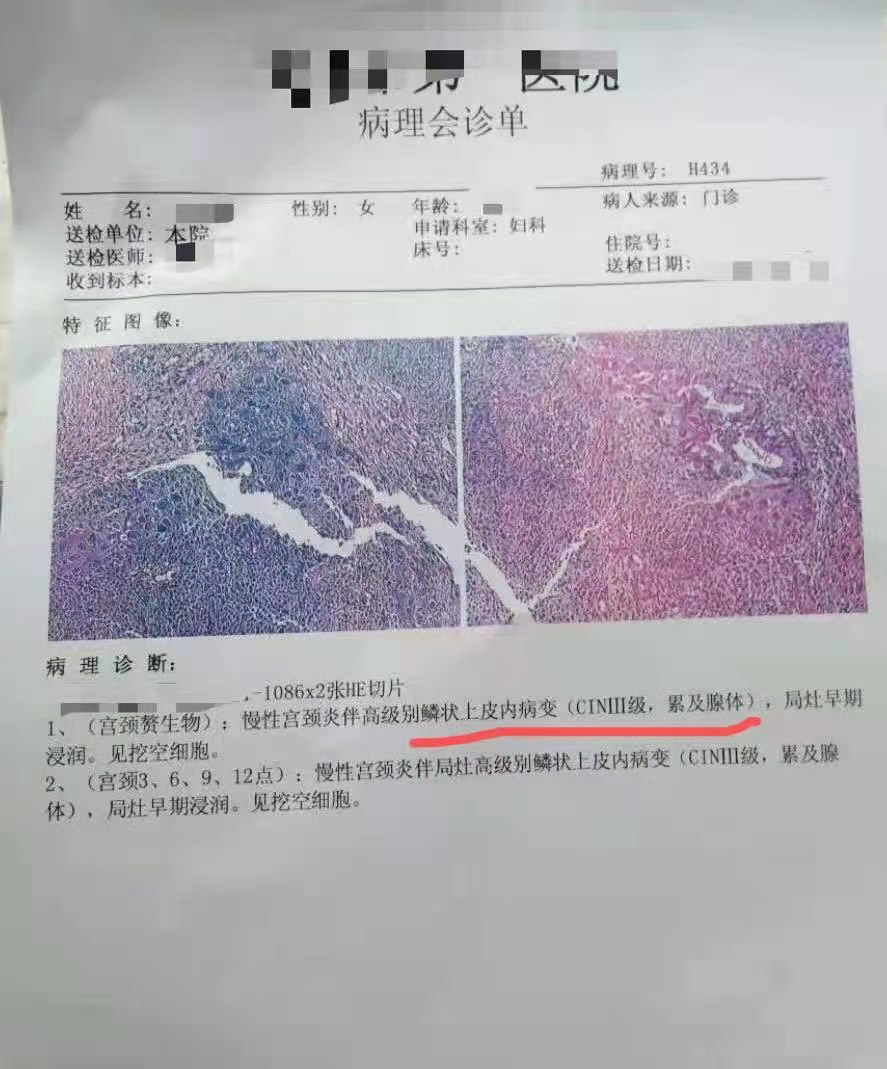 一文看懂宫颈活检cin3和重疾险的关系?
