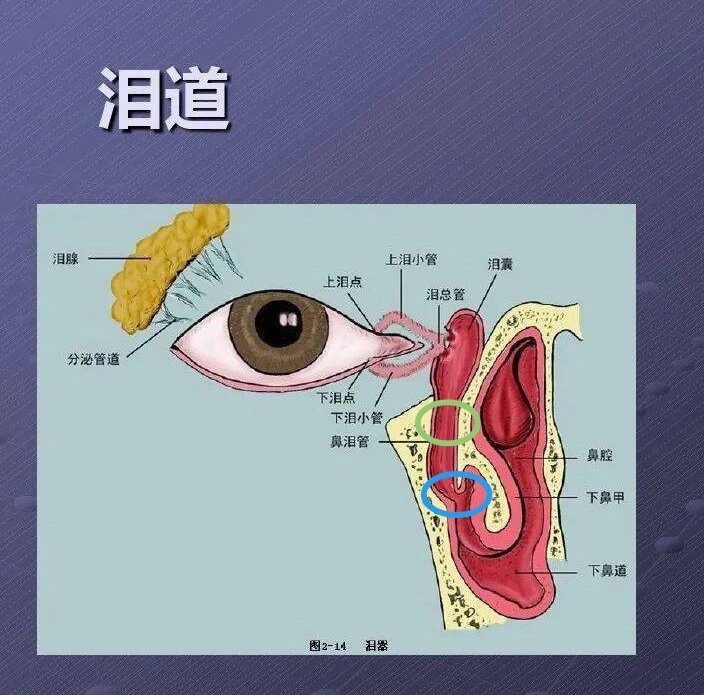 6个月泪道探通术 宝宝从出生到现在6m 9d一直泪道不通,今天带她去医院