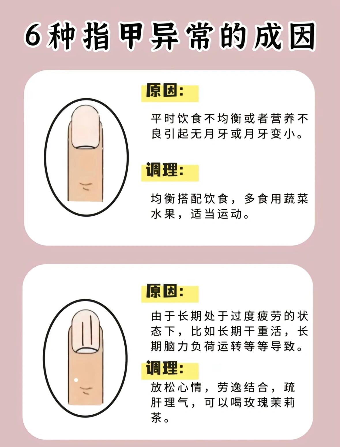 手指上的月牙代表什么图片