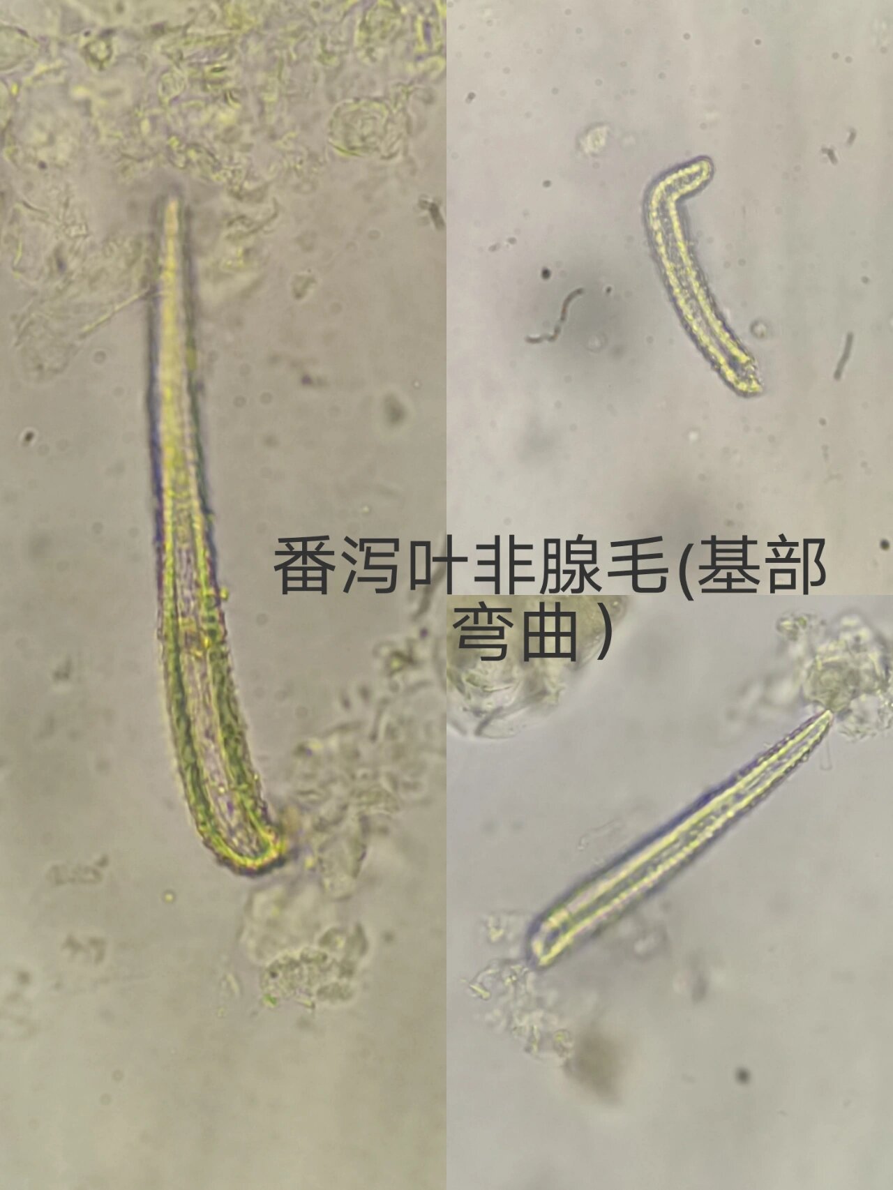 番泻叶粉末显微特征图 ·非腺毛