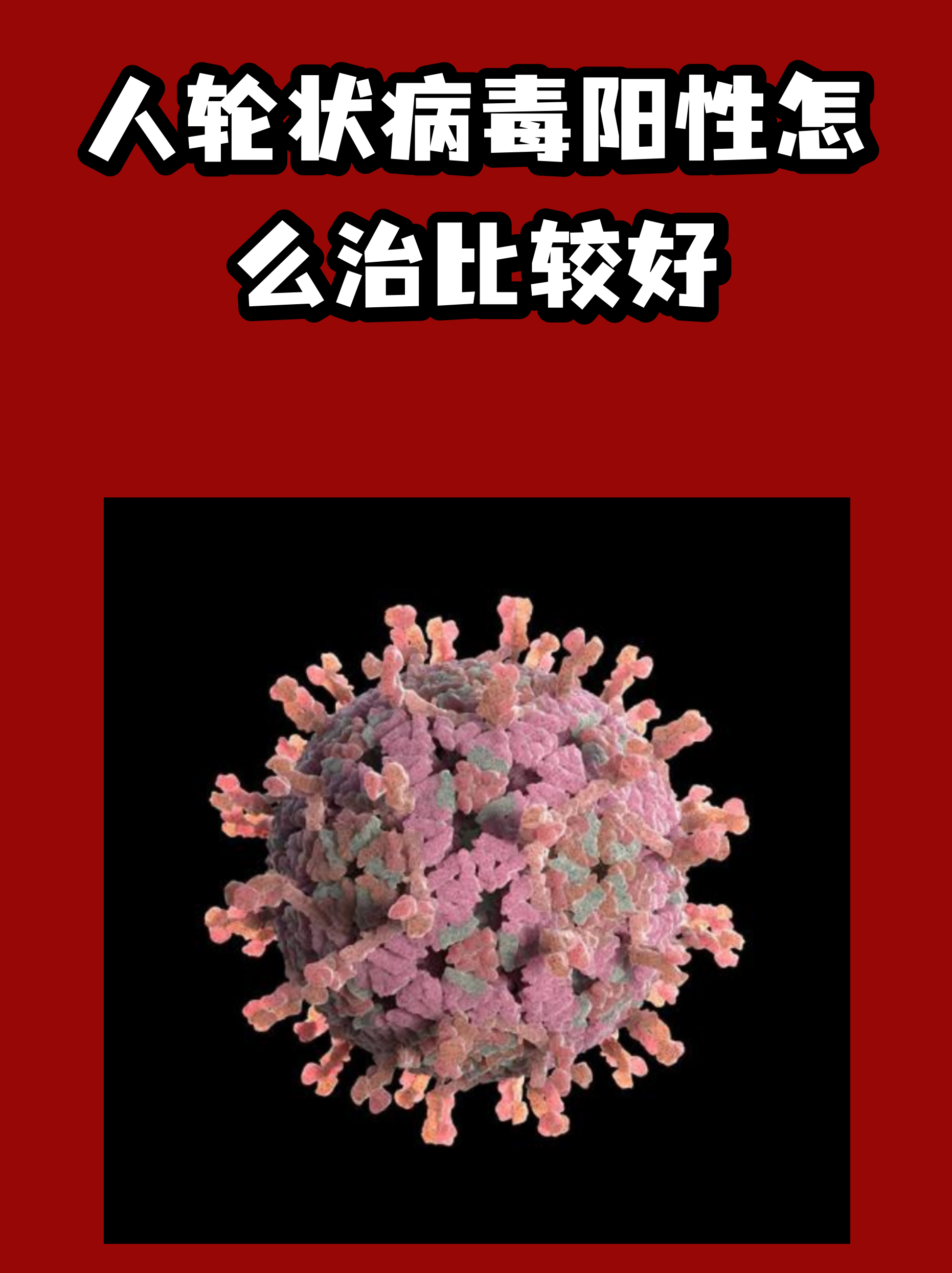 疫情到底是什么引起的病毒呢的简单介绍