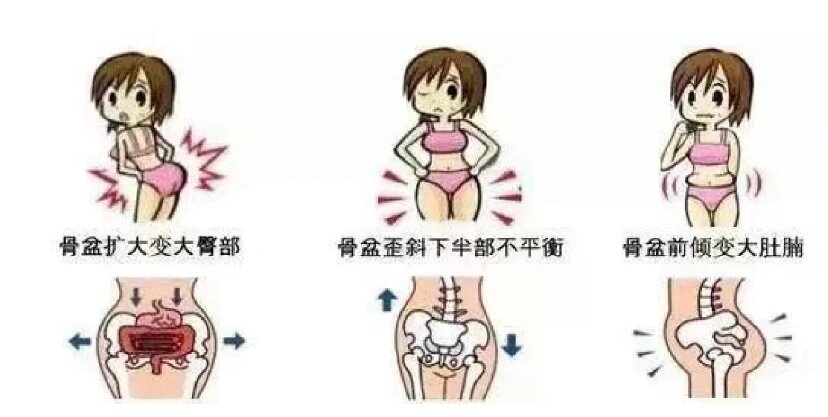 骨盆旋转的危害不看不知道,一看吓一跳!