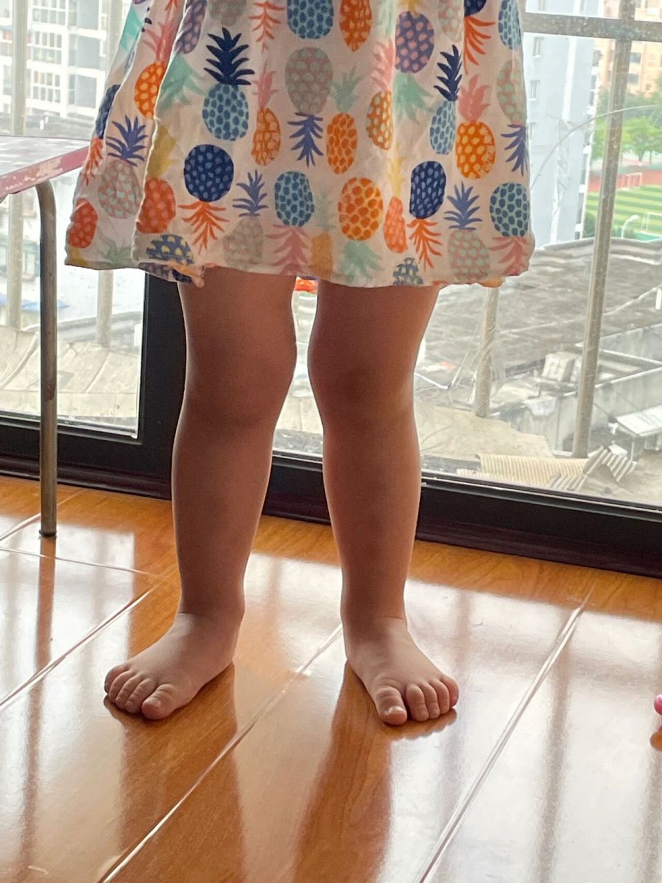 今天早上小朋友在飘窗上玩,突然发现这个腿型好像不对,她平时走路,跑