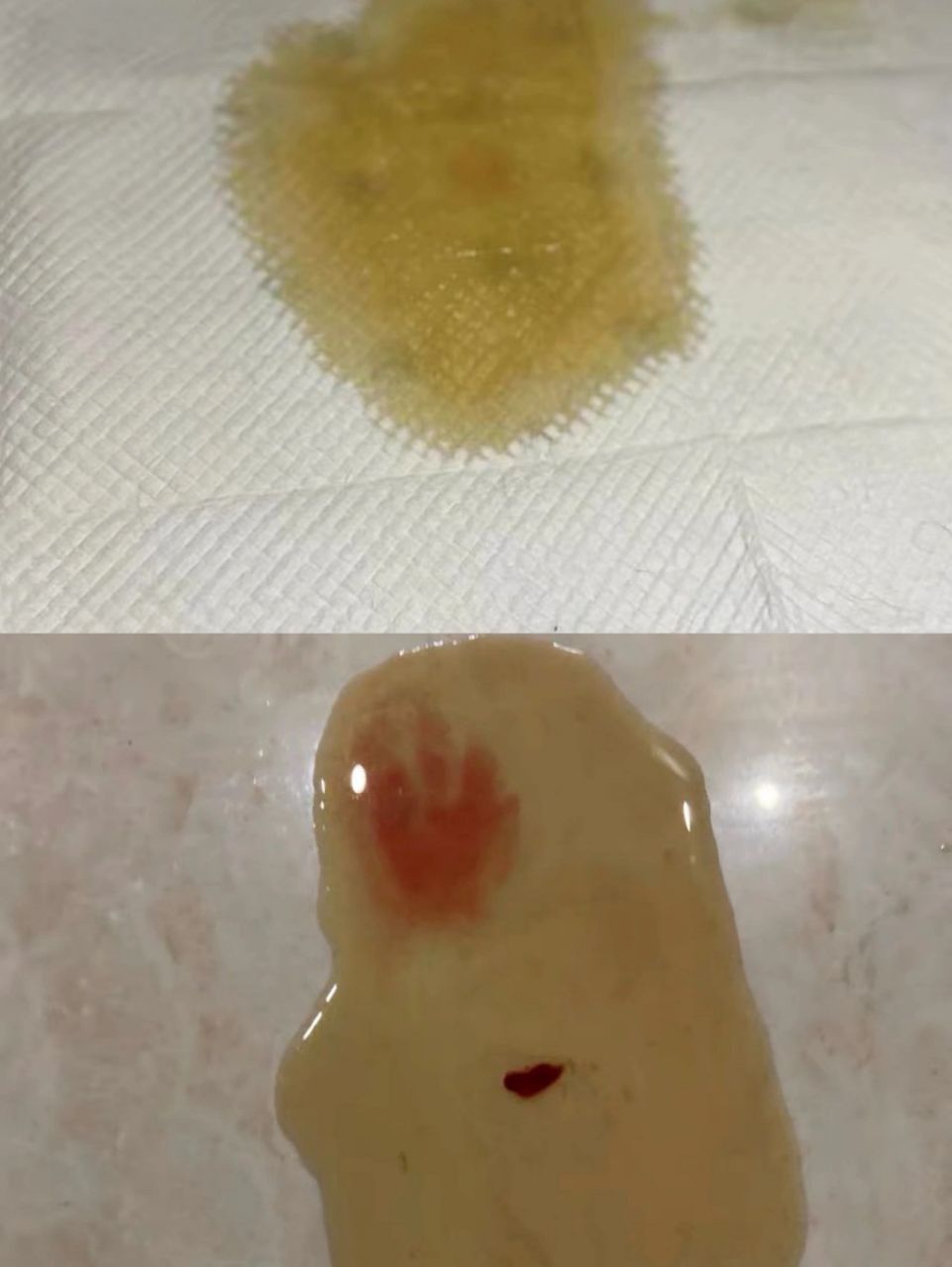 尿路感染还尿血 看完这篇,一定要回去看看你家狗狗尿尿正常不正常!