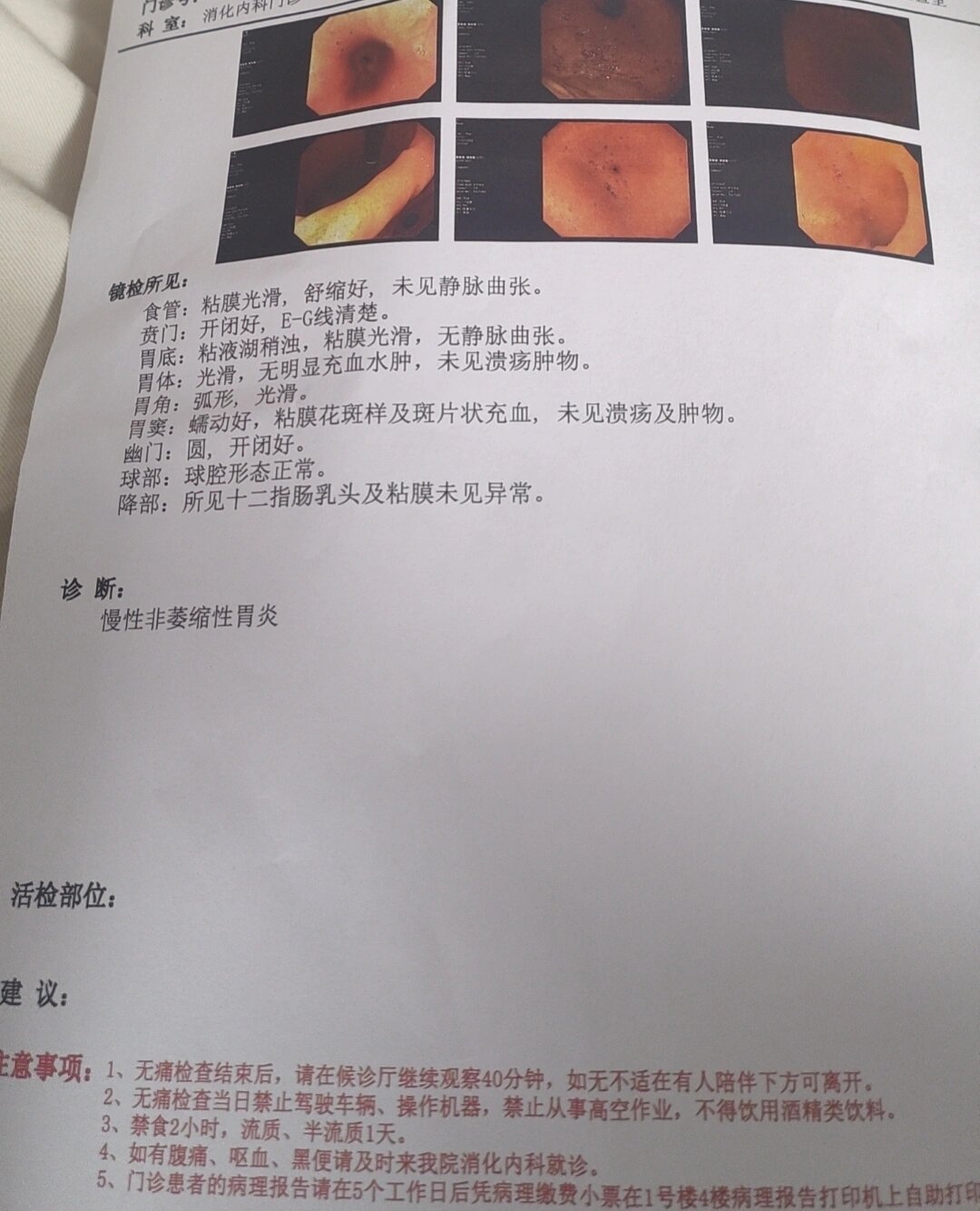 预约单无痛胃肠镜收费单据上海胃镜检查缴费票单图片无痛胃镜胃药单子