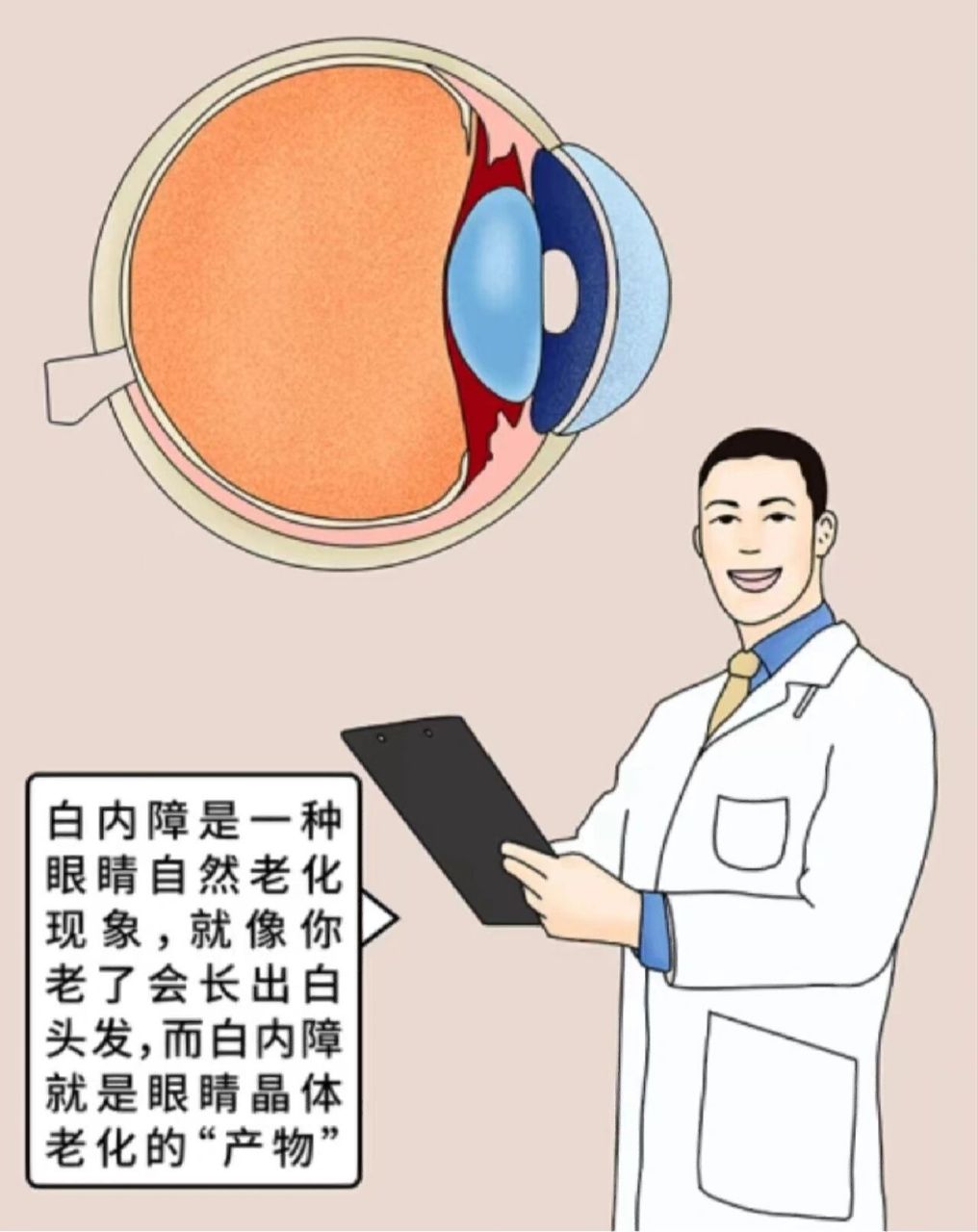 白内障(cataract)是由于晶状体混浊导致的视觉障碍性疾病.