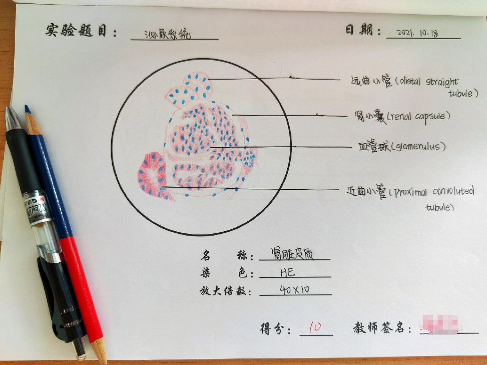 正常肾切片红蓝手绘图图片