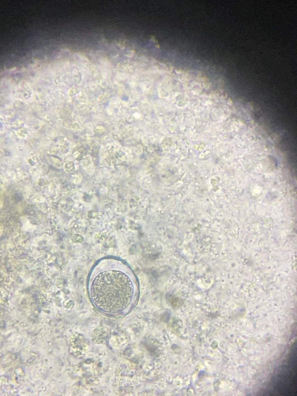 鸡球虫显微镜图片