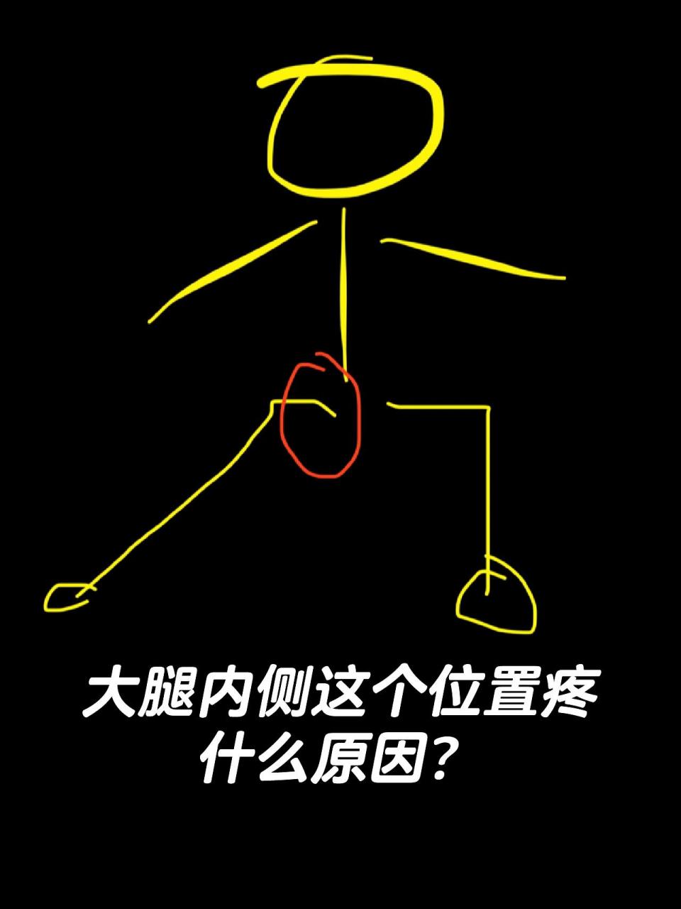 大腿根内侧腹股沟内侧疼是什么原因啊 向外开,外旋,做前后屈腿拉伸和