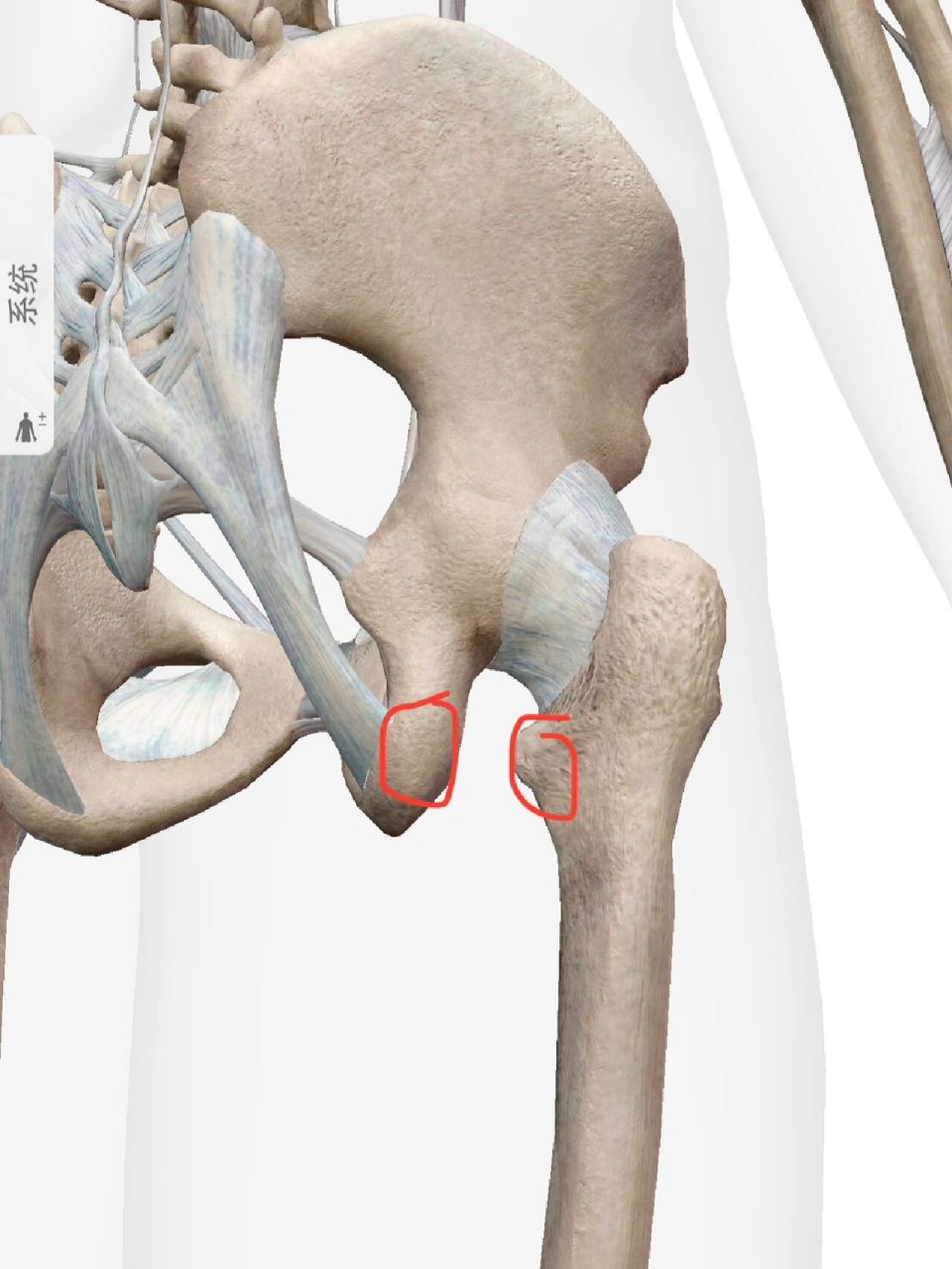 髋撞康复 底层逻辑分析 (3) 第三种(ifi)就是坐骨股骨撞击, 害怕大幅