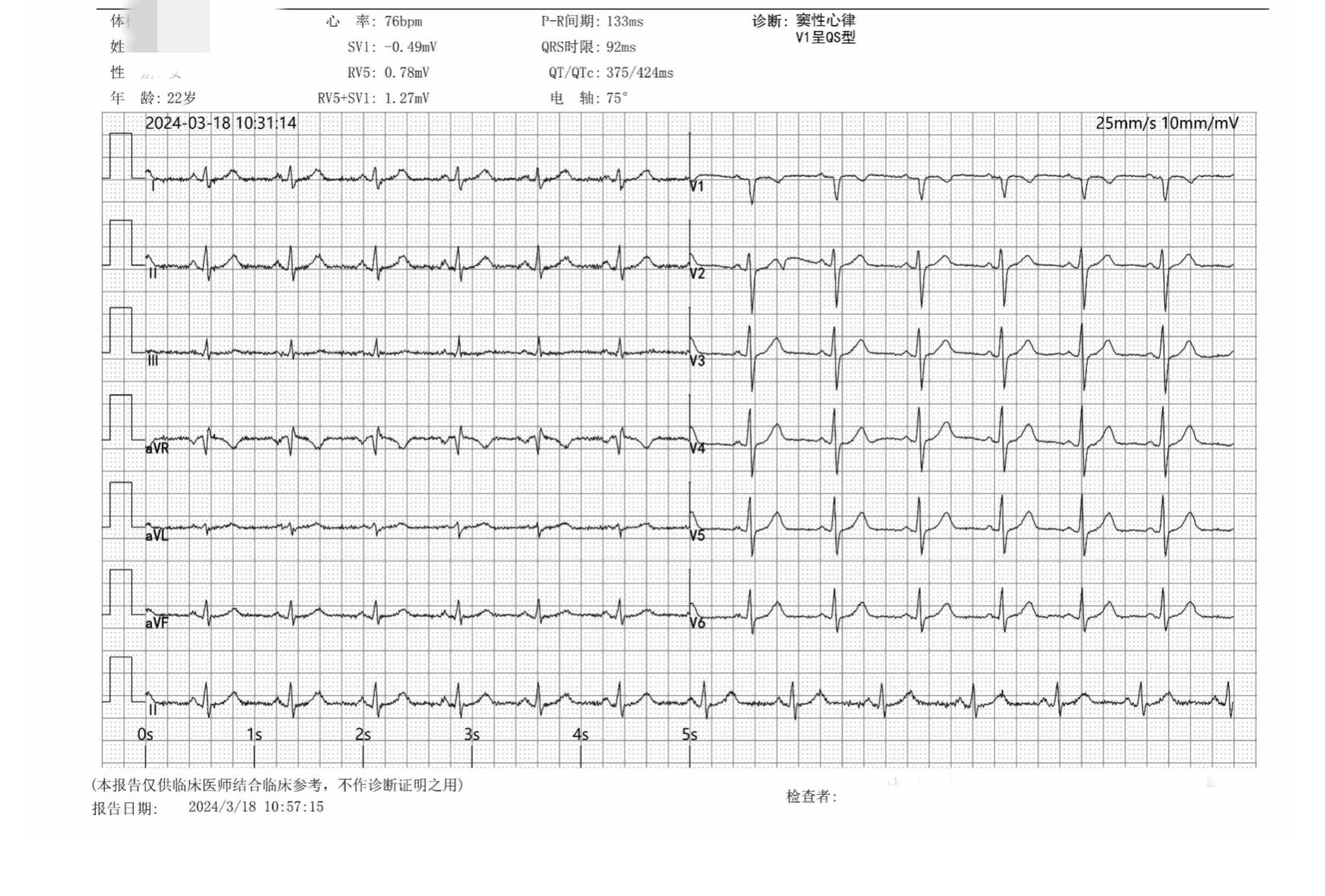入职体检心电图被卡