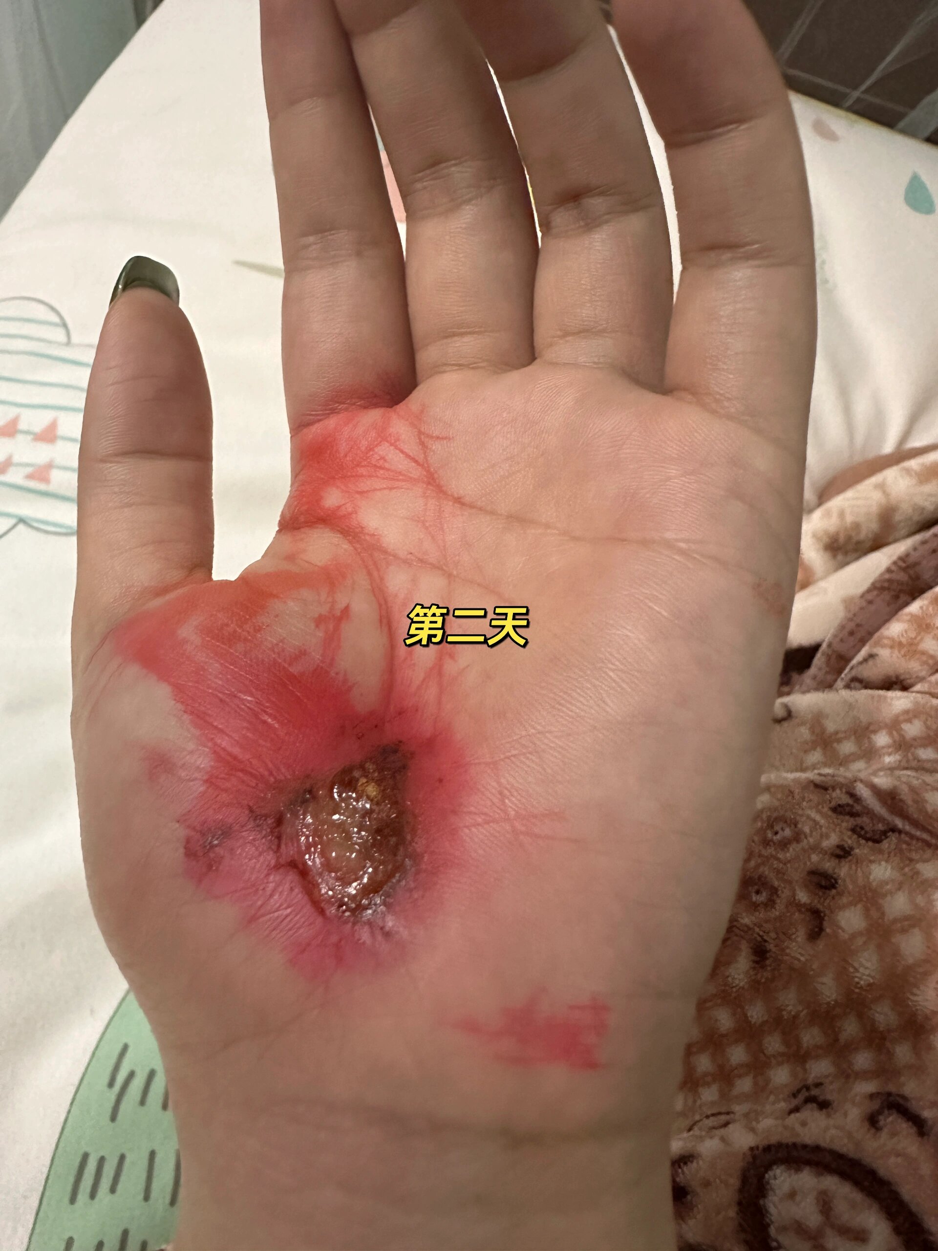 都处于一种懵圈的状态,第一次被撞没有经验