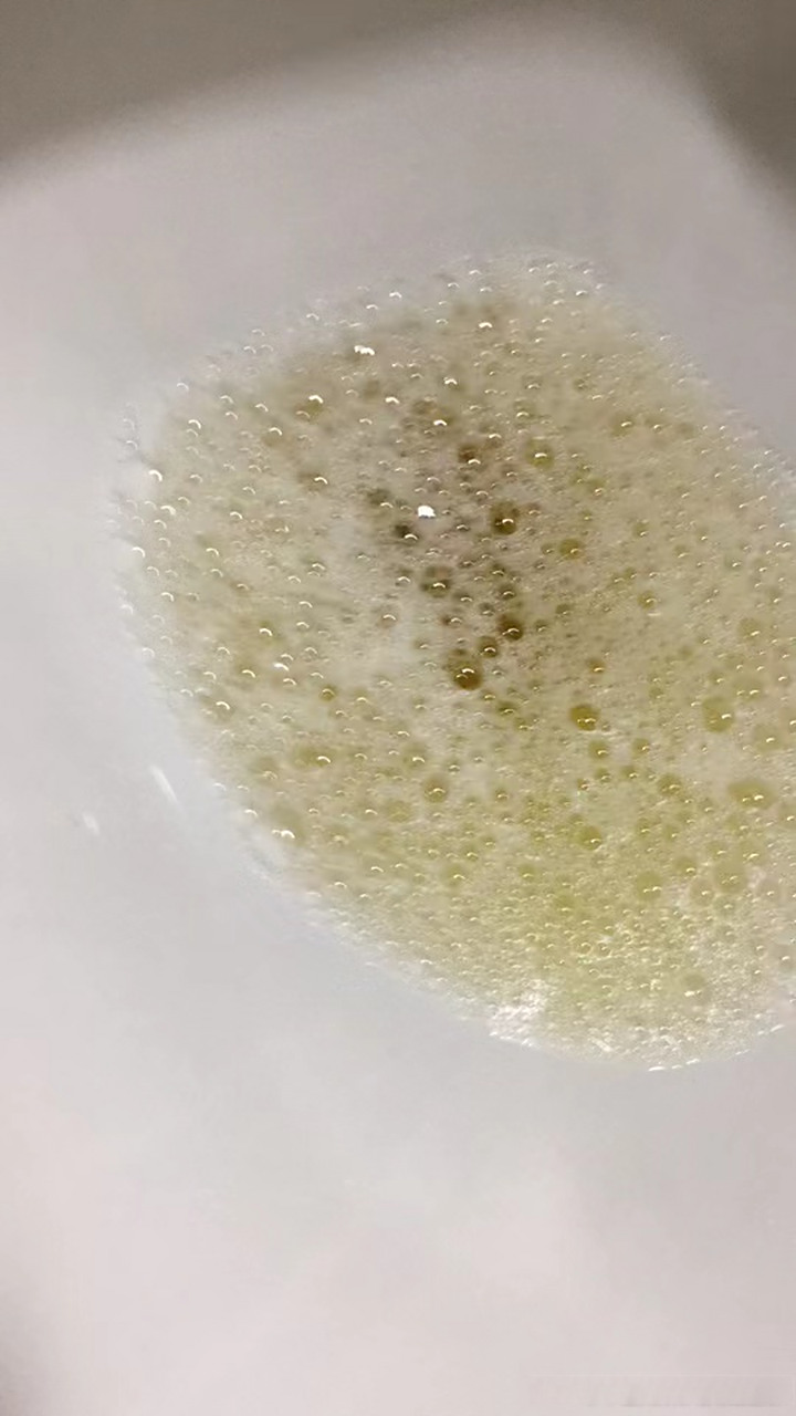 患者自述10年前因多饮多尿在当地医院被确诊为2