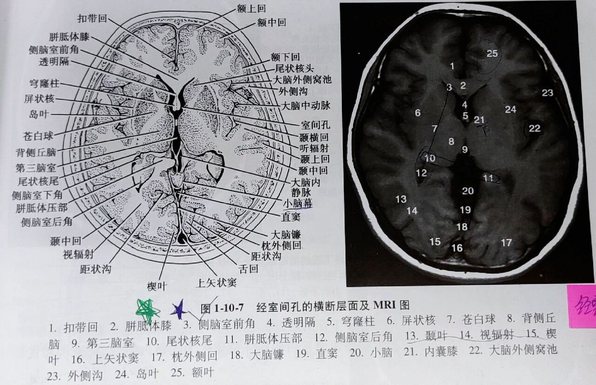 《头部的断面解剖及影像①》 1.经中央旁小叶上份的横断层面 2.