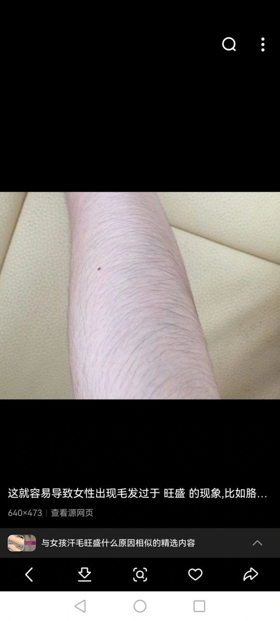 小女孩毛发旺盛怎么办 我闺女8岁了,汗毛多,经常有小同学好奇,每天都