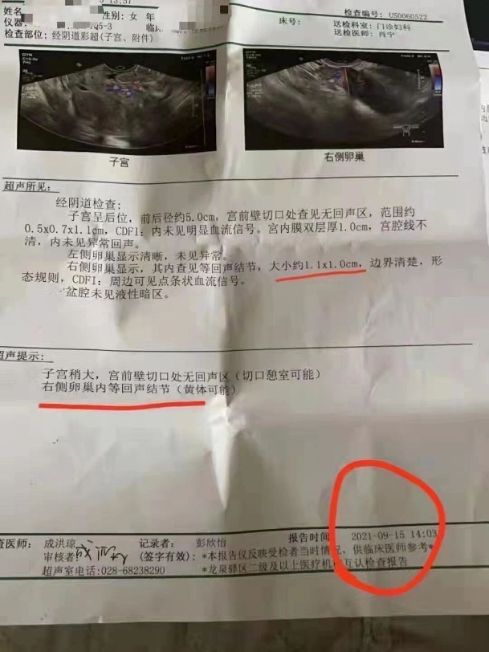 宫颈囊肿 是不是有点好了