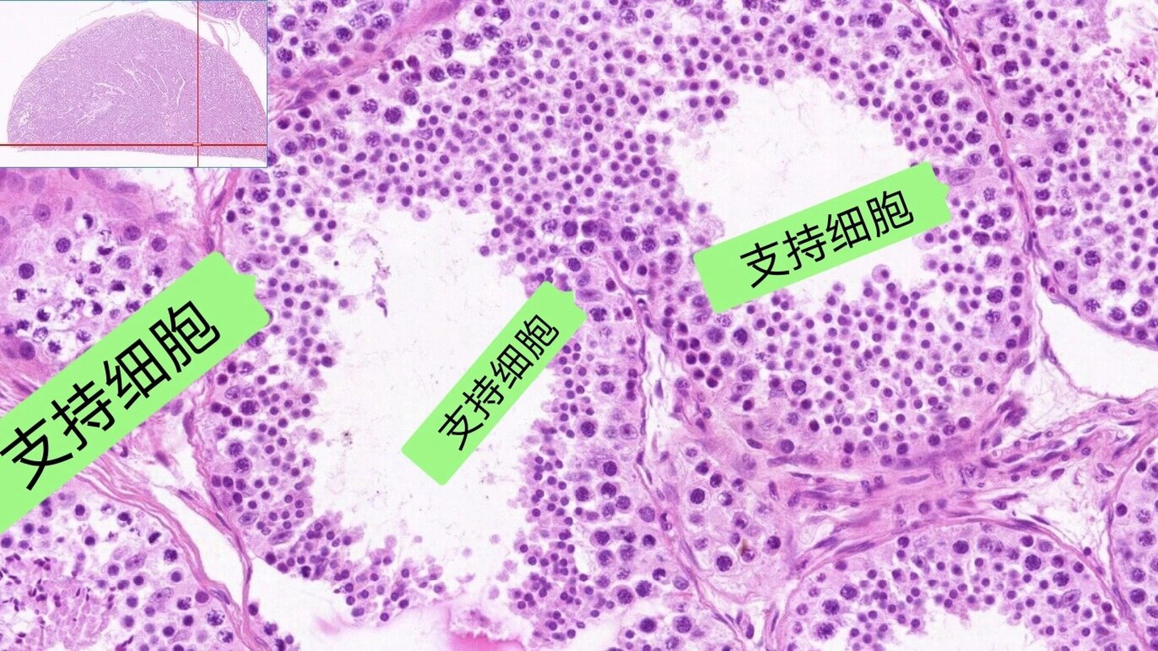 男性生殖系统——睾丸 生精小管相关结构 精原细胞:紧贴基膜,圆形或卵