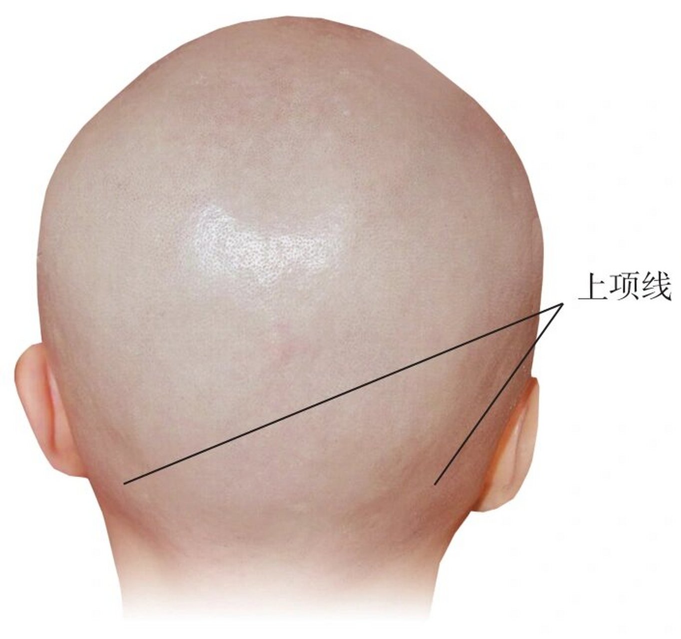 人体体表解剖全真图解/颈部体表标志 97枕外凸隆 枕鳞中央的骨性