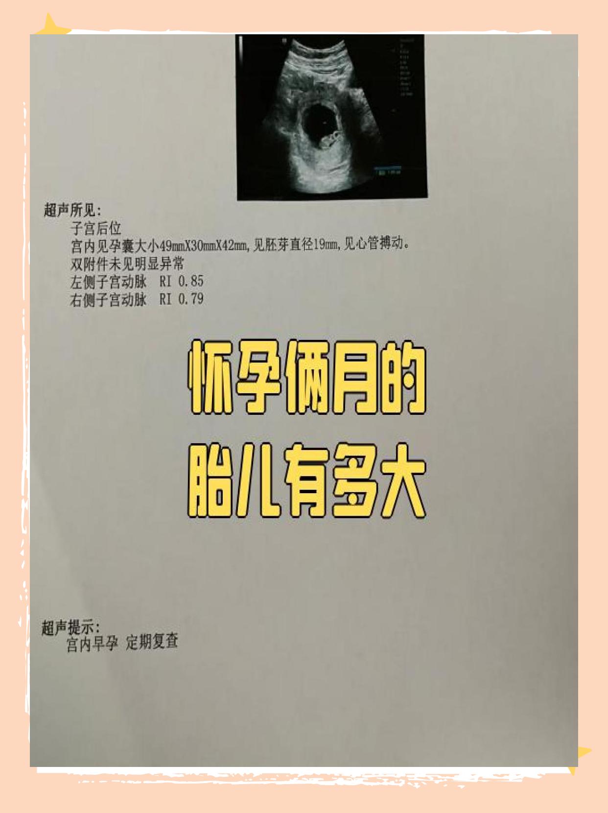 怀孕俩月的胎儿身长约6厘米体重约1克外形像一颗葡萄或草莓籽