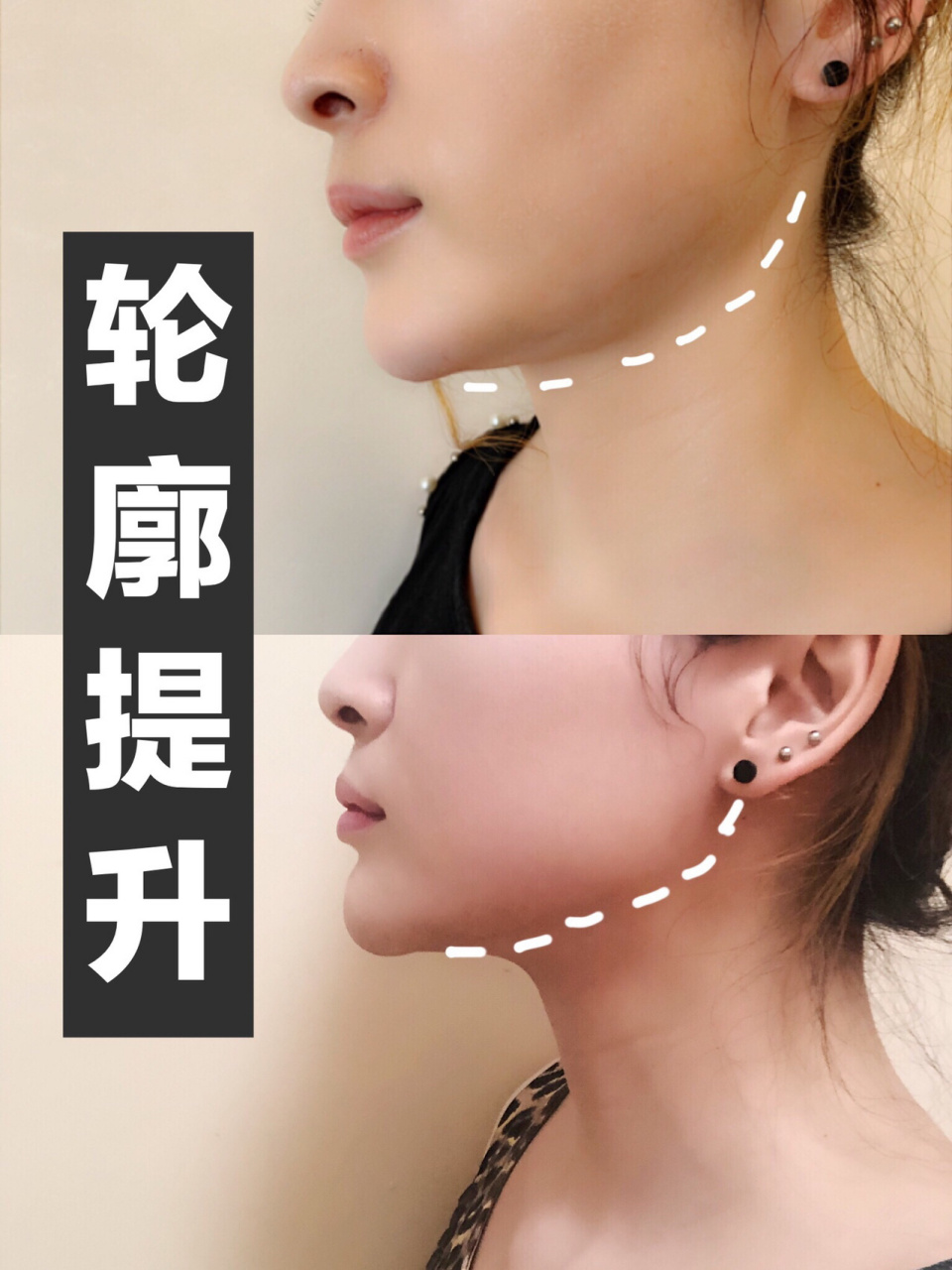 轮廓提94,拜拜双下巴96完美侧脸杀 大家都知道,不是體重輕就看著