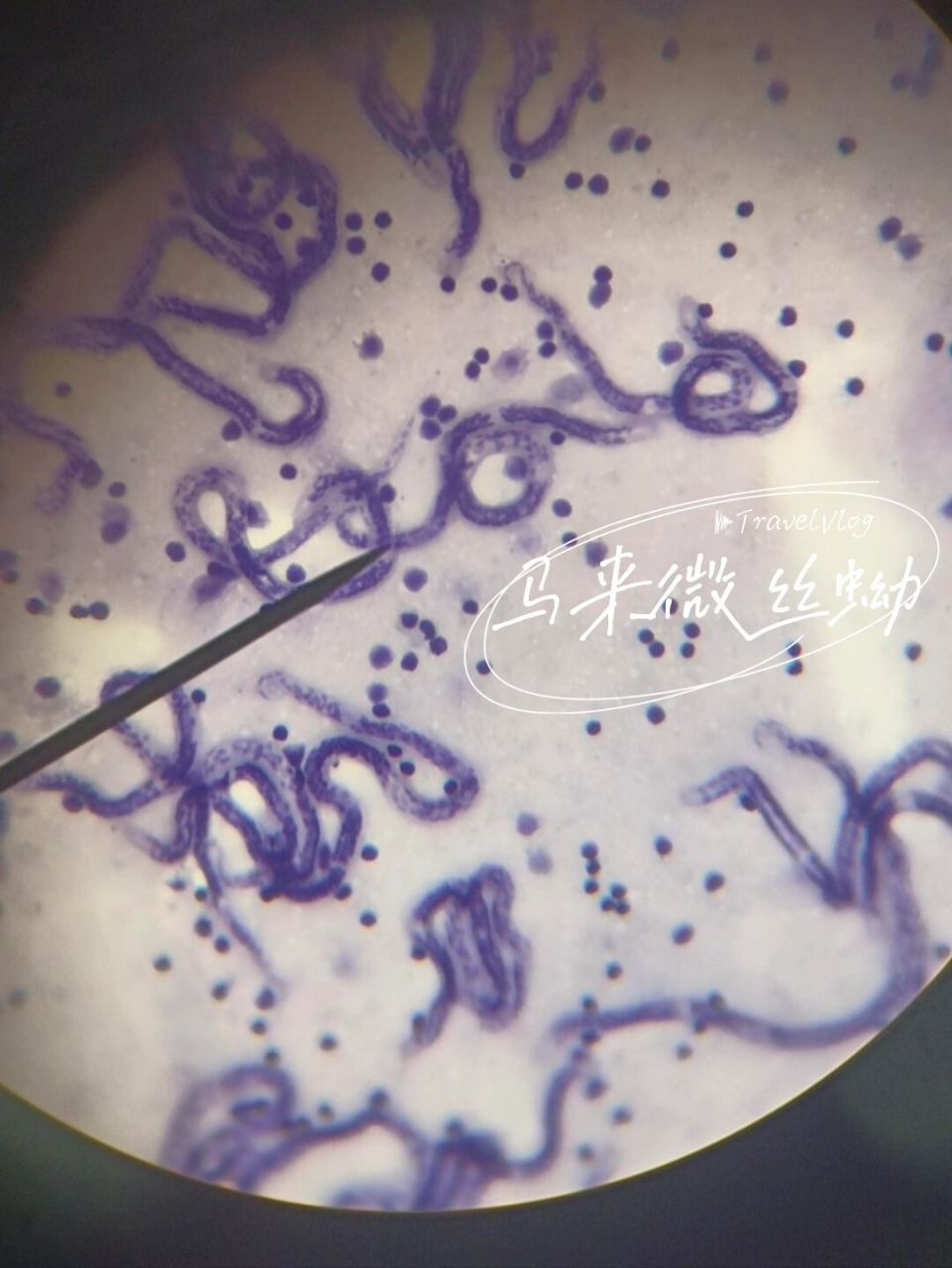 马来微丝蚴,广州管圆线虫 今天观察了 7015班氏丝状蚴 7015