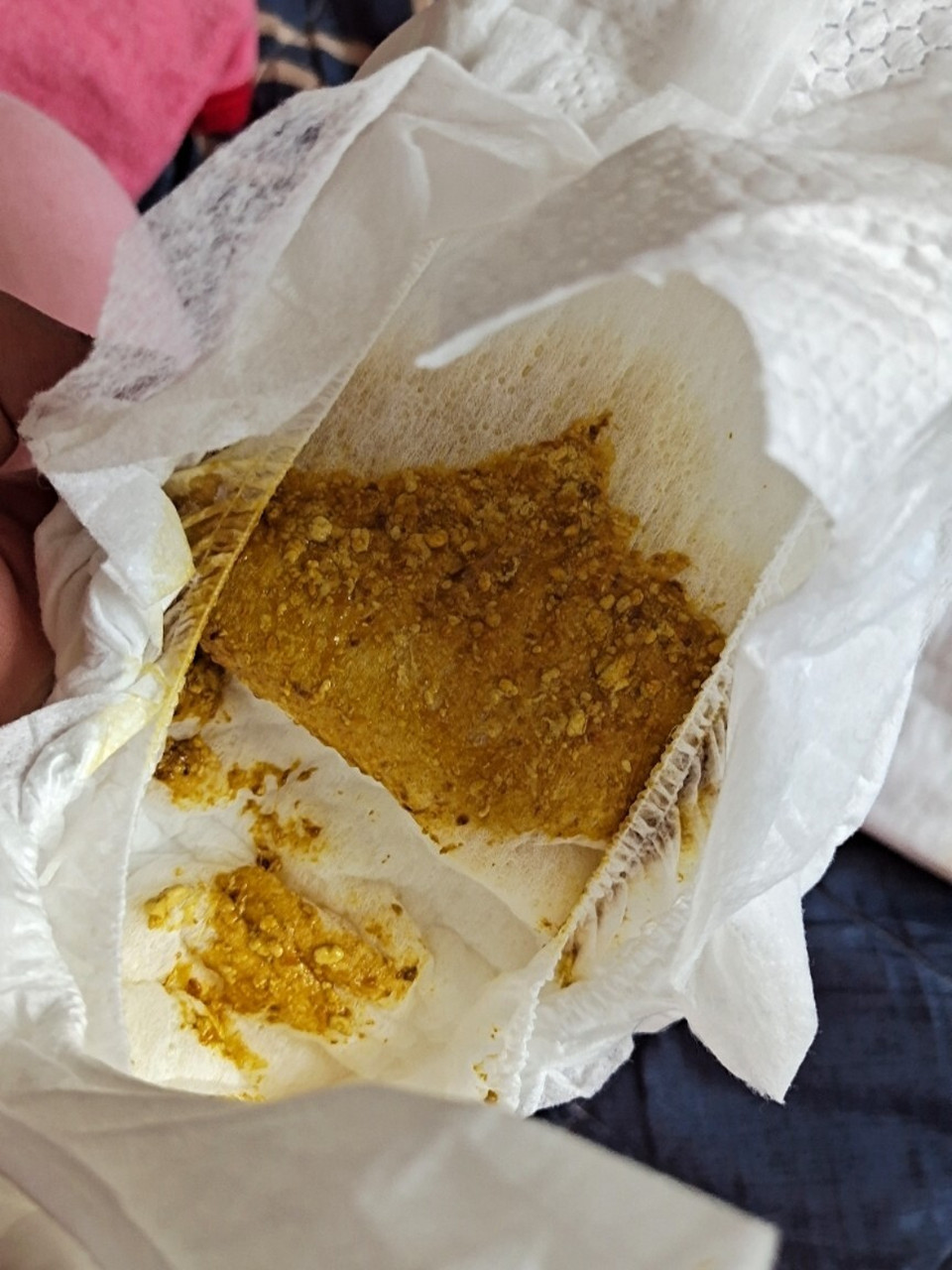 有一粒粒 月子里的宝宝 一开始吃奶吃到最后会哭闹 然后今天拉1次便便