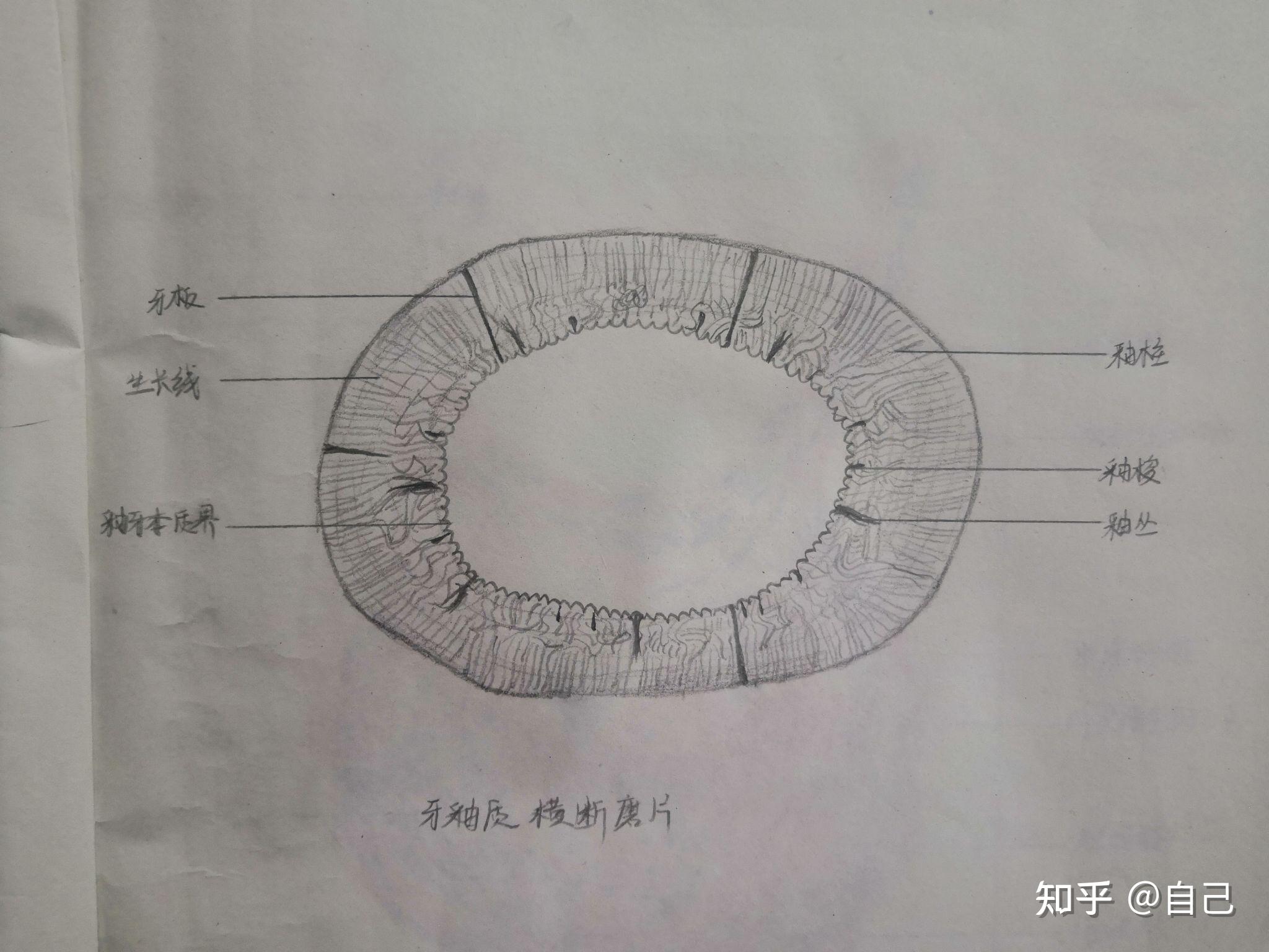 口腔组织病理学红蓝铅笔