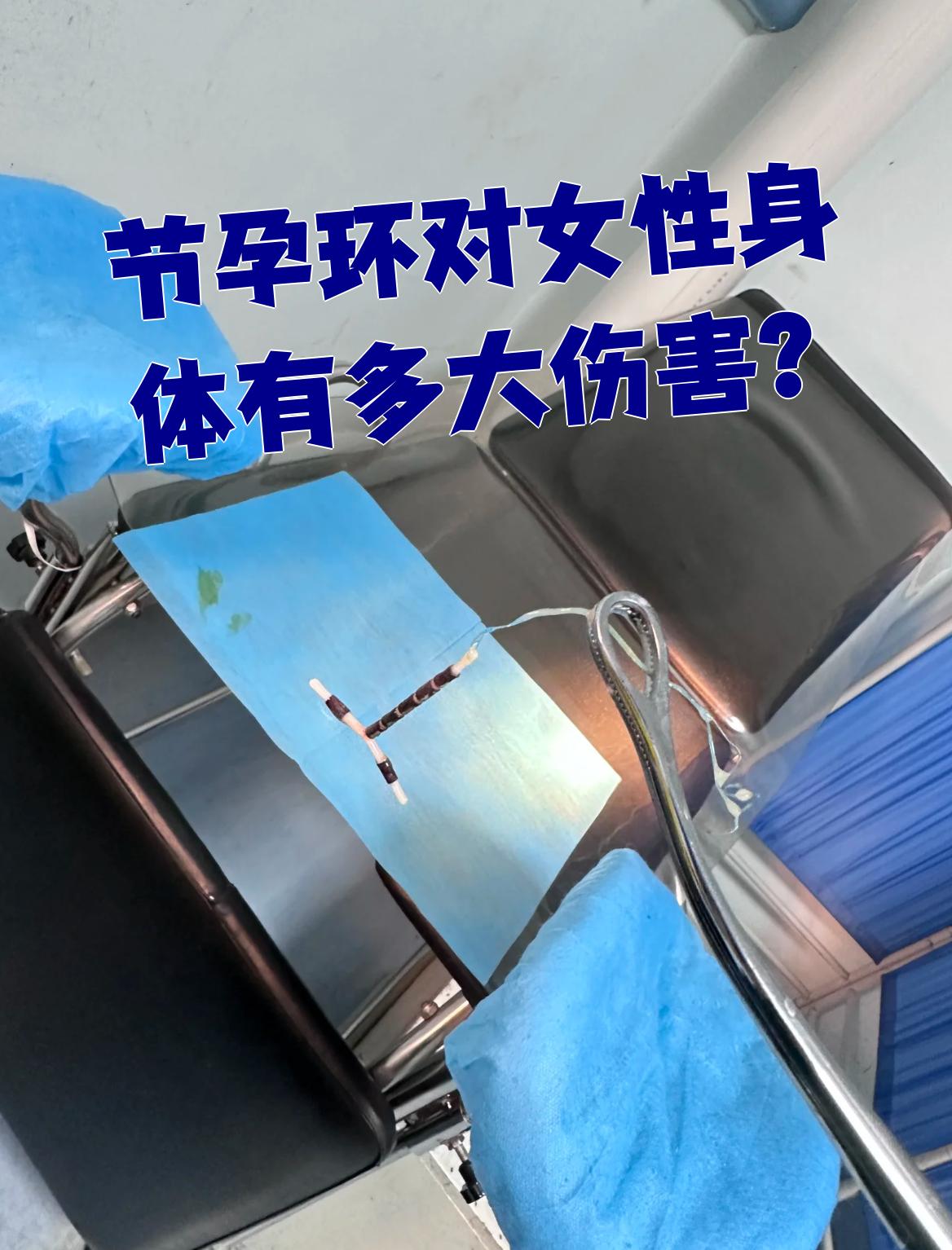 节孕环对女性身体伤害很小,但手术和后期可能出现一些副作用或并发