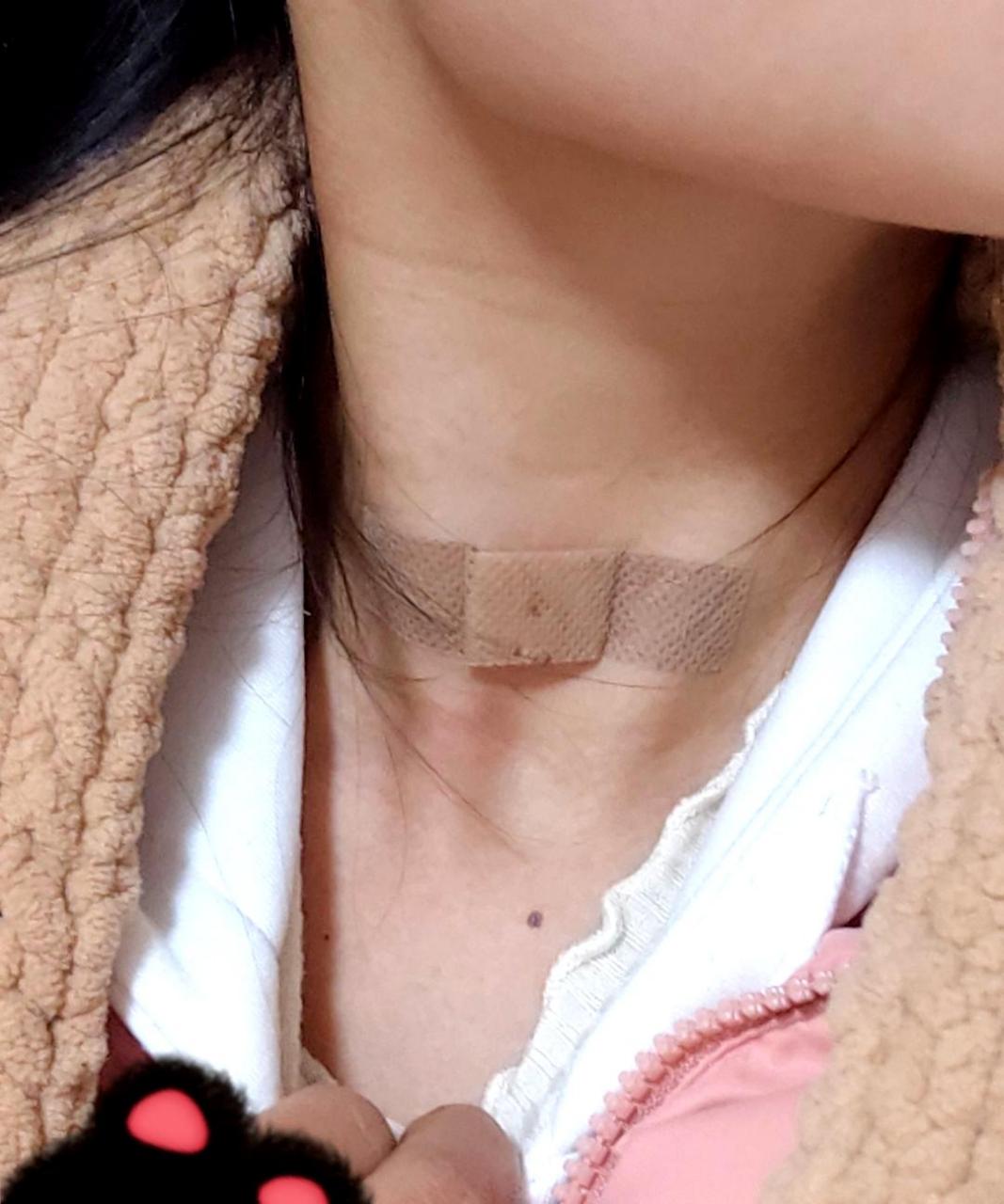 脖子正中心的痣,戴了18年的免费项链.