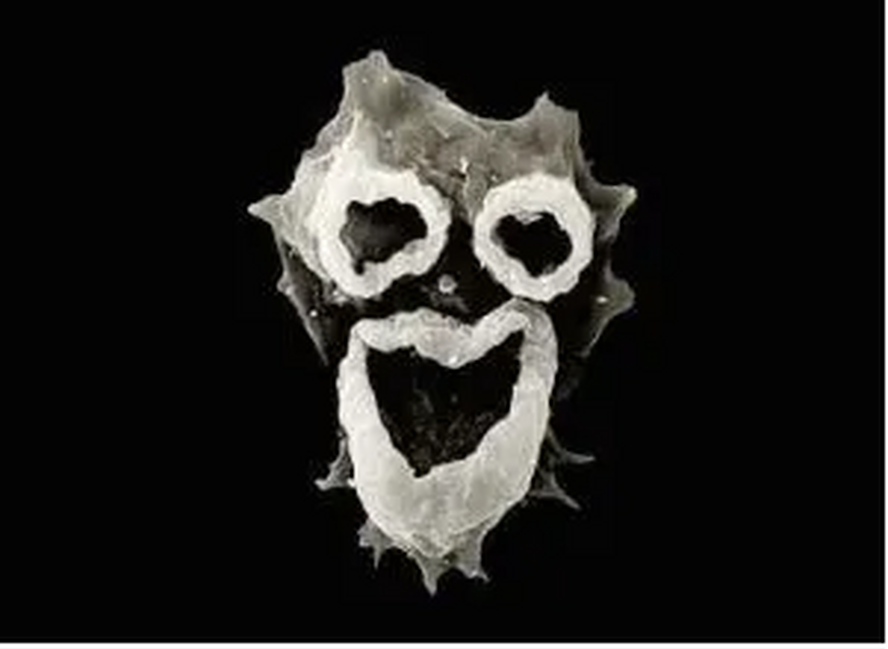 美国再现食脑虫#福氏耐格里变形虫是食脑变形虫的学名,它们能"吃"人